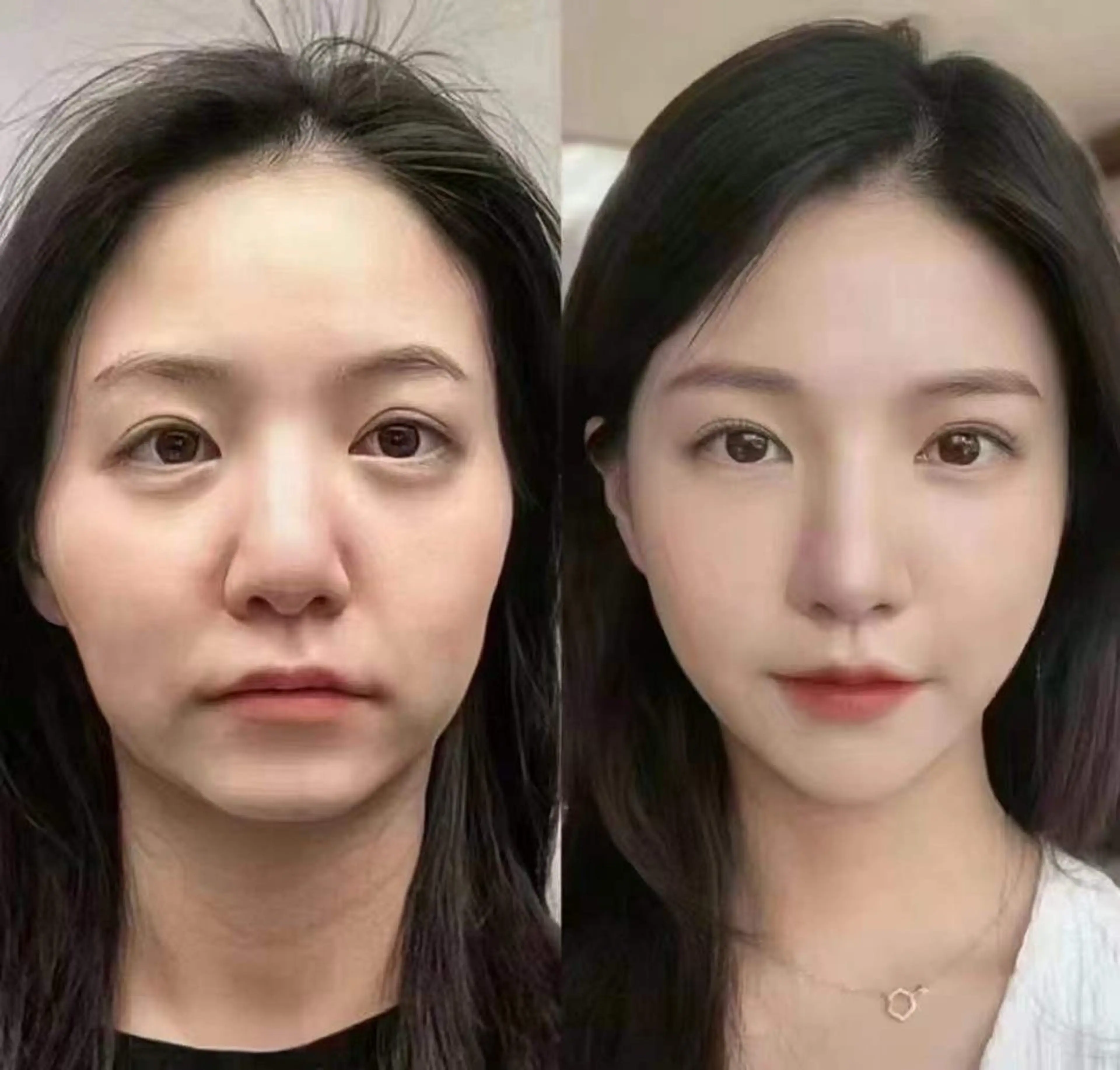 マツエク・マツパ 韓国風マツエク エステ aliaハイフ&水光ジェットサロン所属・aliaハーブ水光店 エステティシャン募集のエステ・リラクイメージ