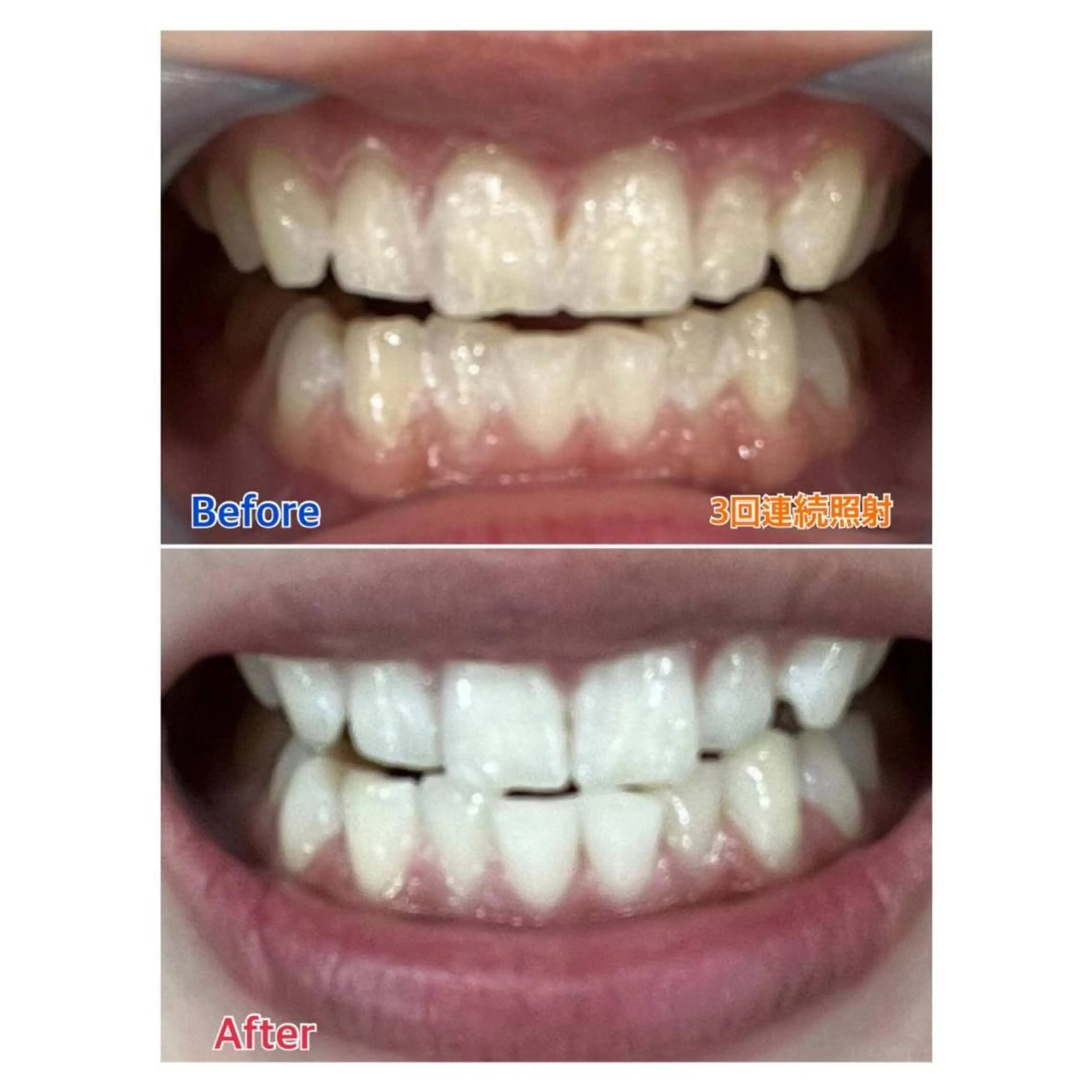 MBEAUTYSALON 千葉店・京成大久保所属・Melty 輝のその他イメージ