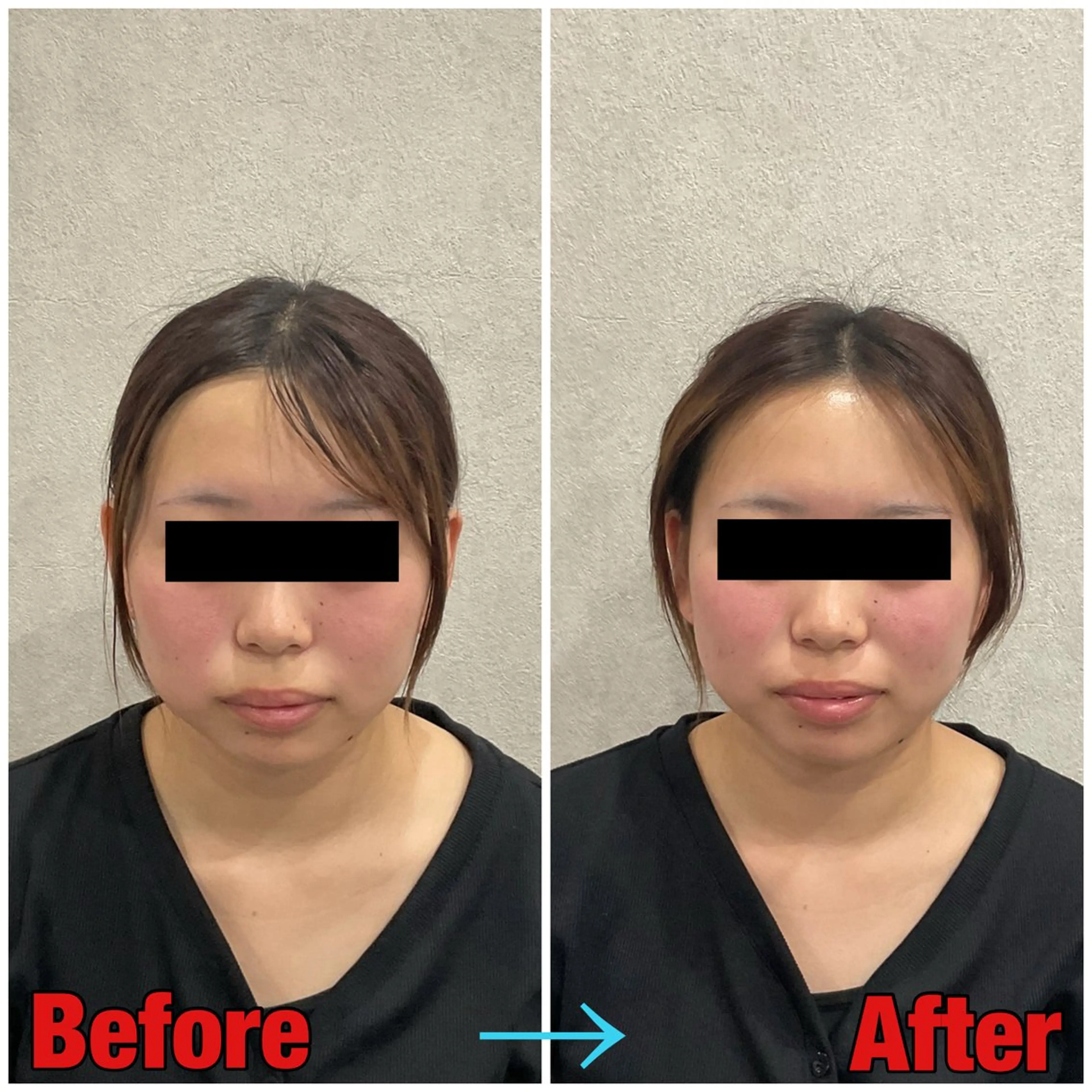 エステ リラク 小顔矯正・美容鍼 FLOW鍼灸整体院のエステ・リラクイメージ