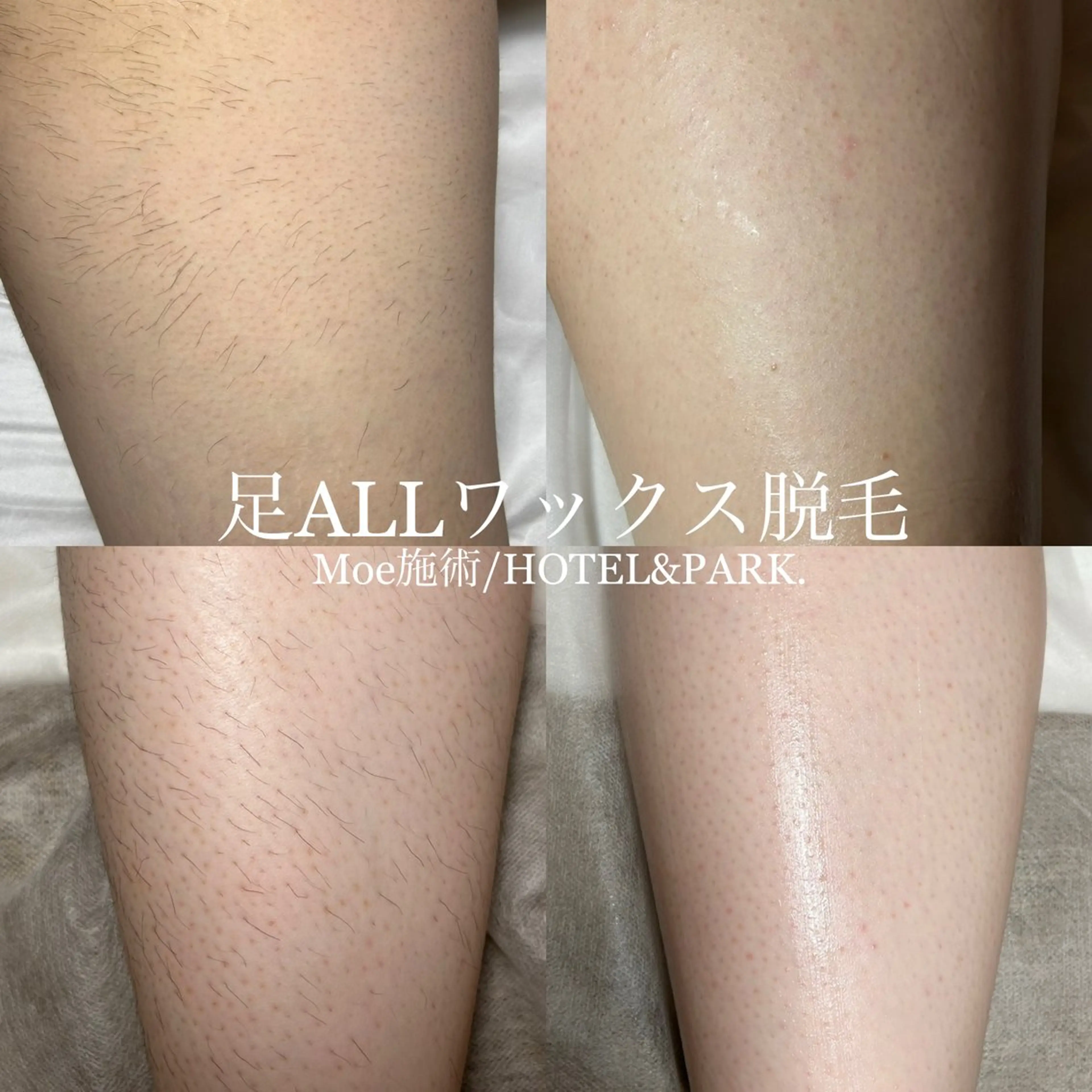 HOTEL&PARK .Moeワックス脱毛のエステ・リラクイメージ