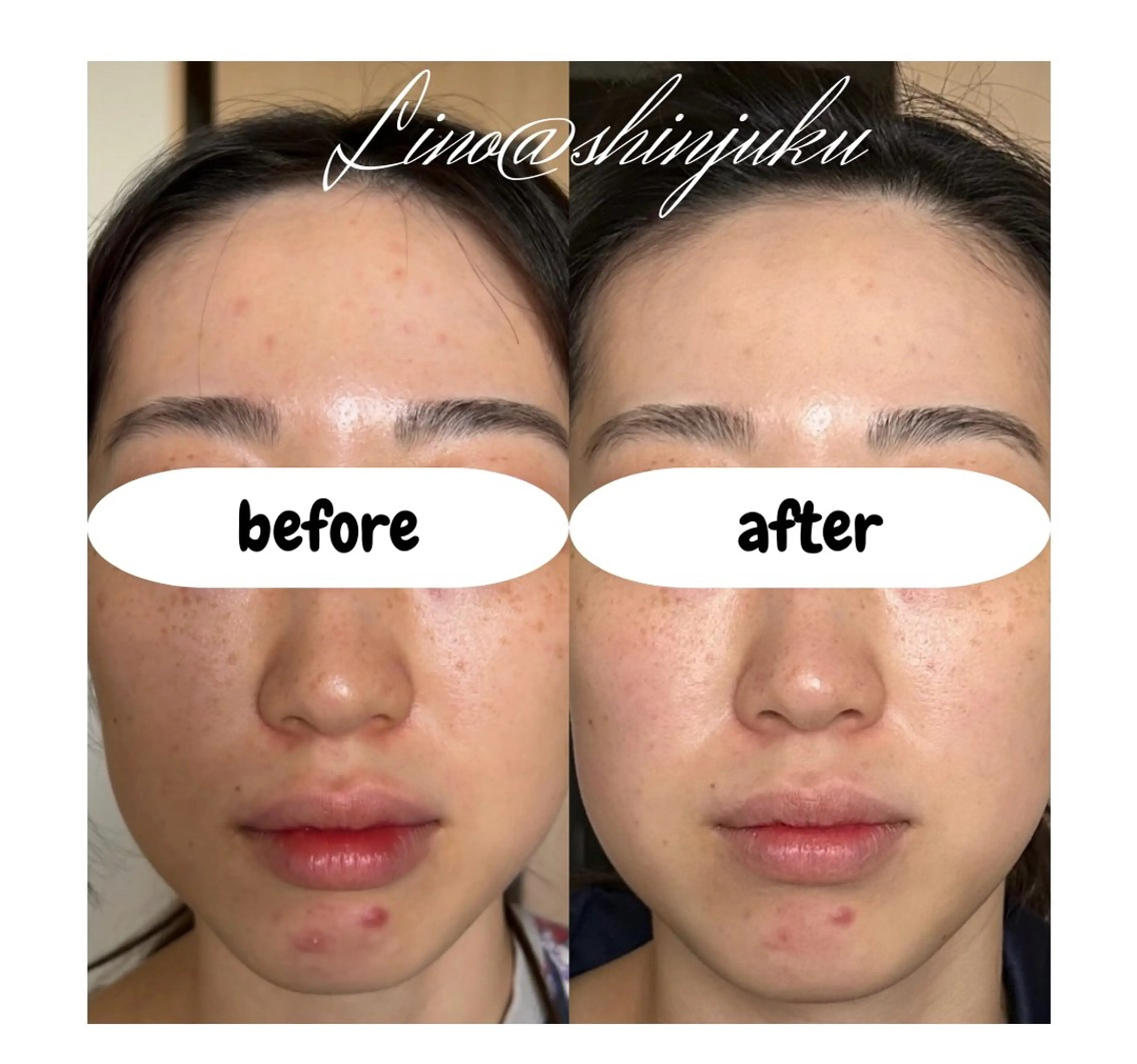 美腸サロン🌺 腸もみ/小顔/リンパのエステ・リラクイメージ