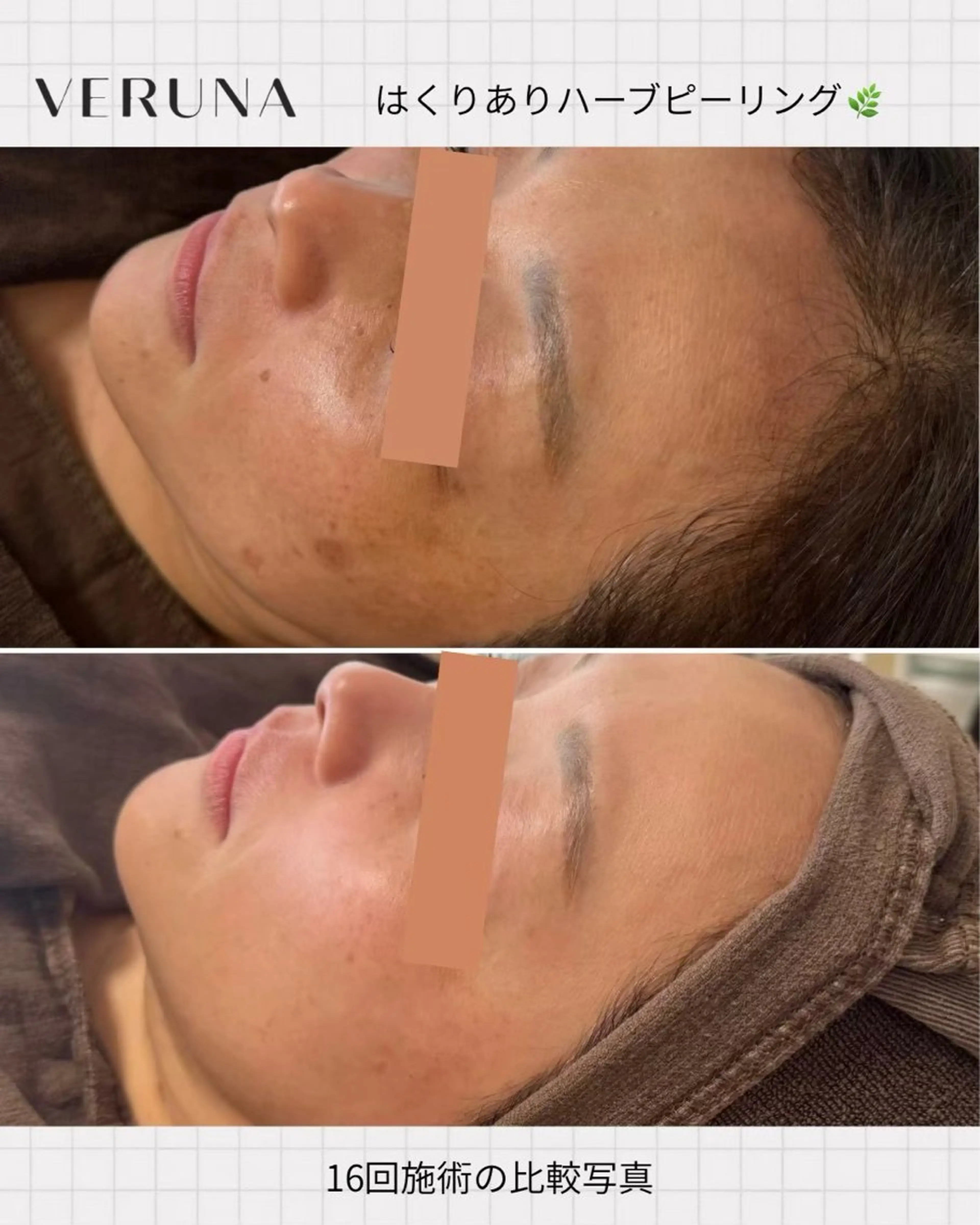 Les Prages（プラージュ）所属・サロン プラージュのエステ・リラクイメージ