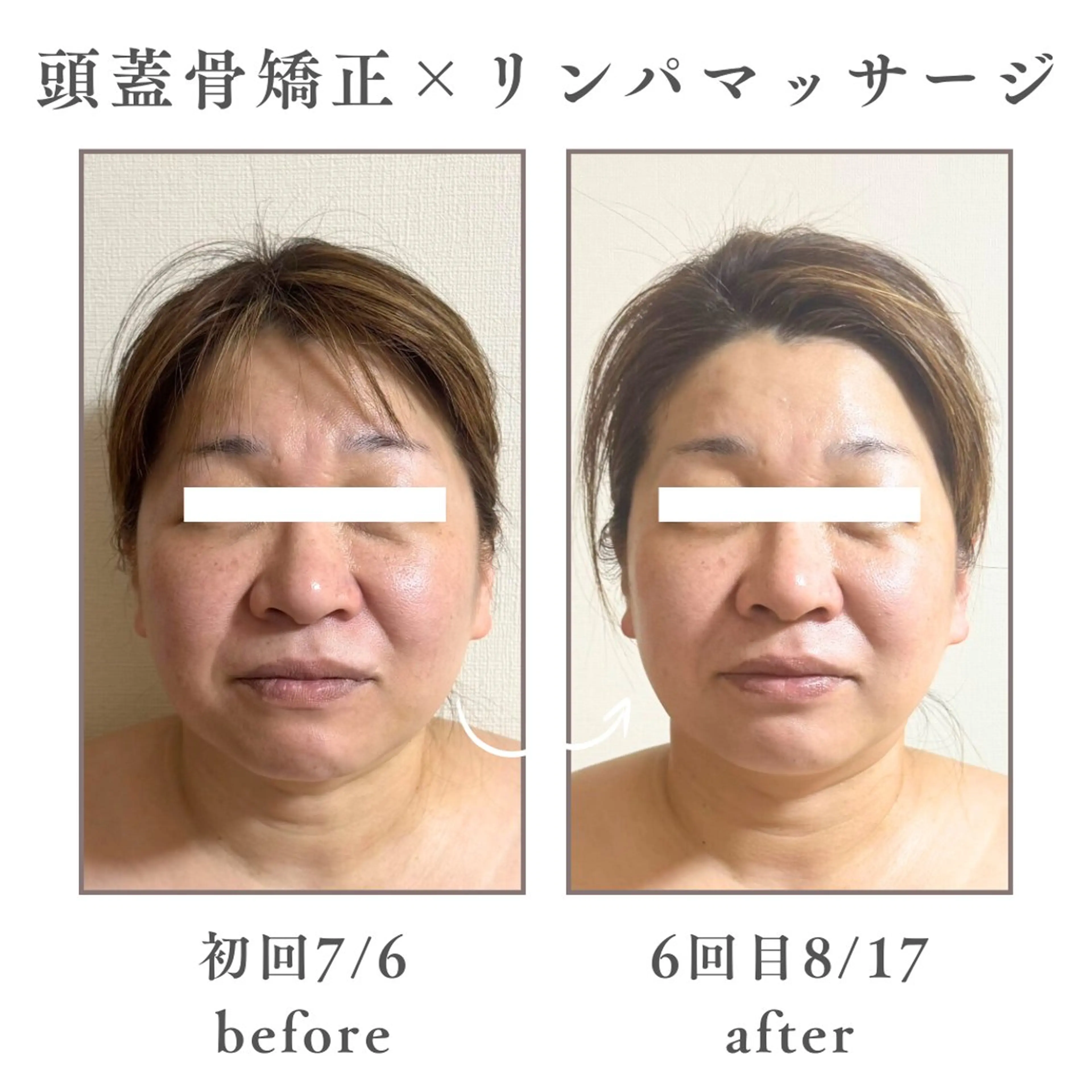 Mignon Lulu🎀のエステ・リラクイメージ