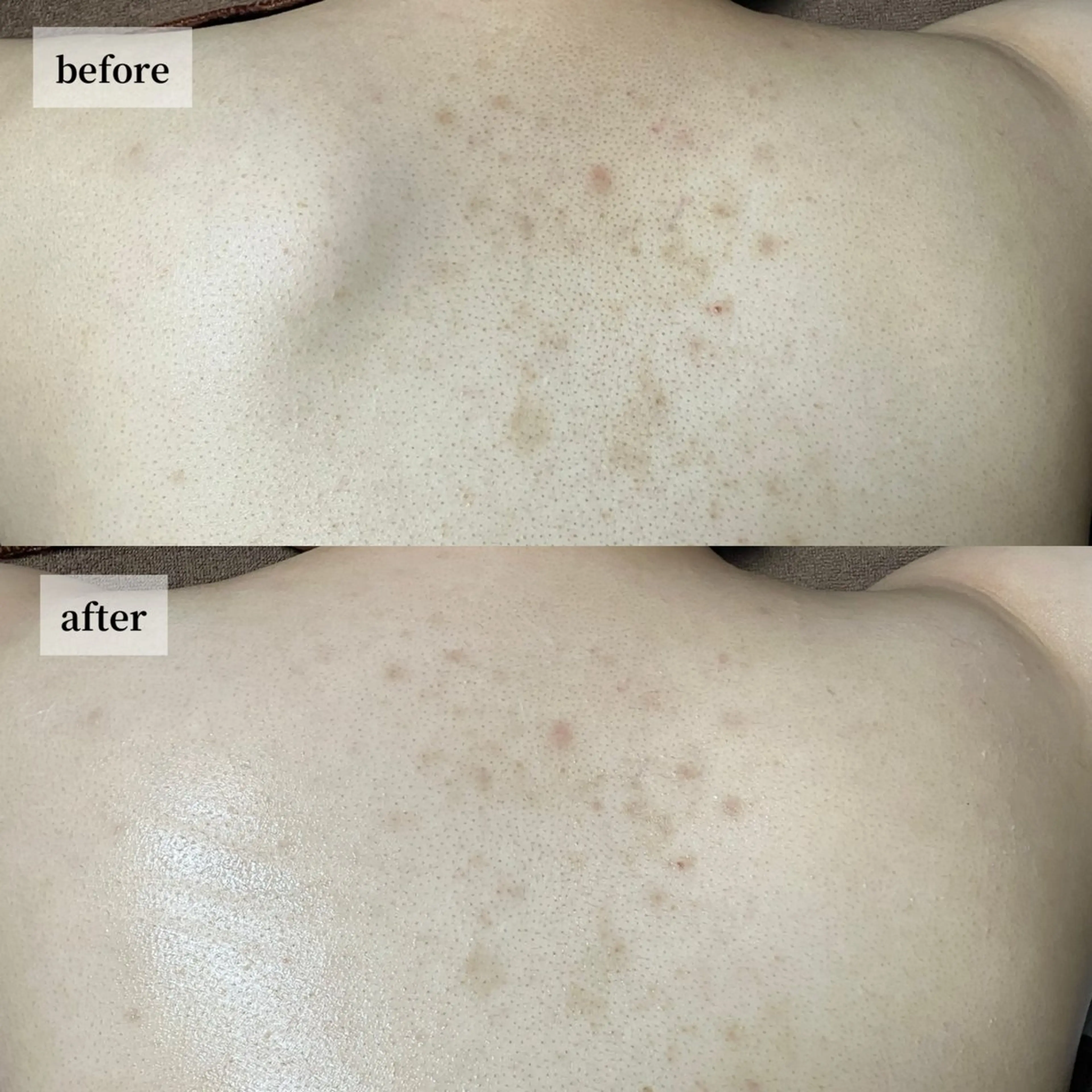 HINANO矢場町店【ヒナノ】所属・脱毛/肌改善🌿 HINANO 村田のエステ・リラクイメージ