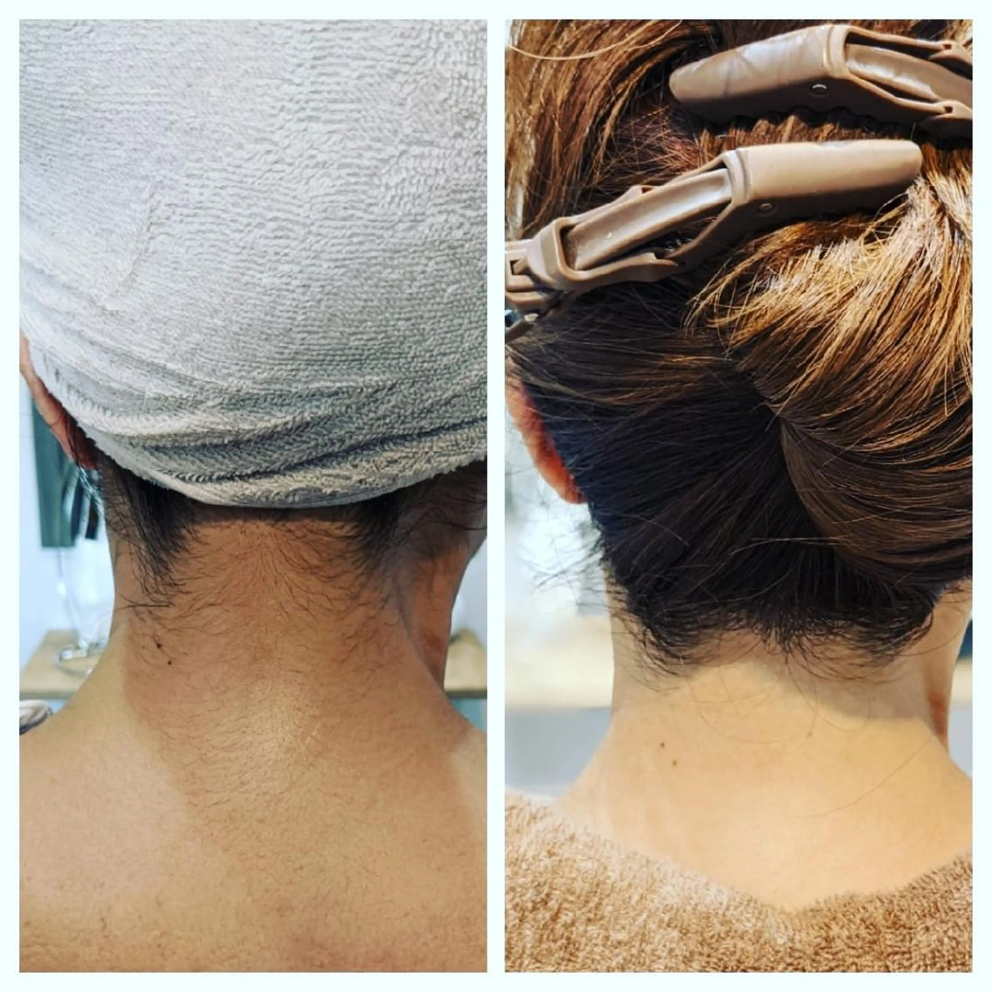 🟡レディース シェービングサロン/のエステ・リラクイメージ