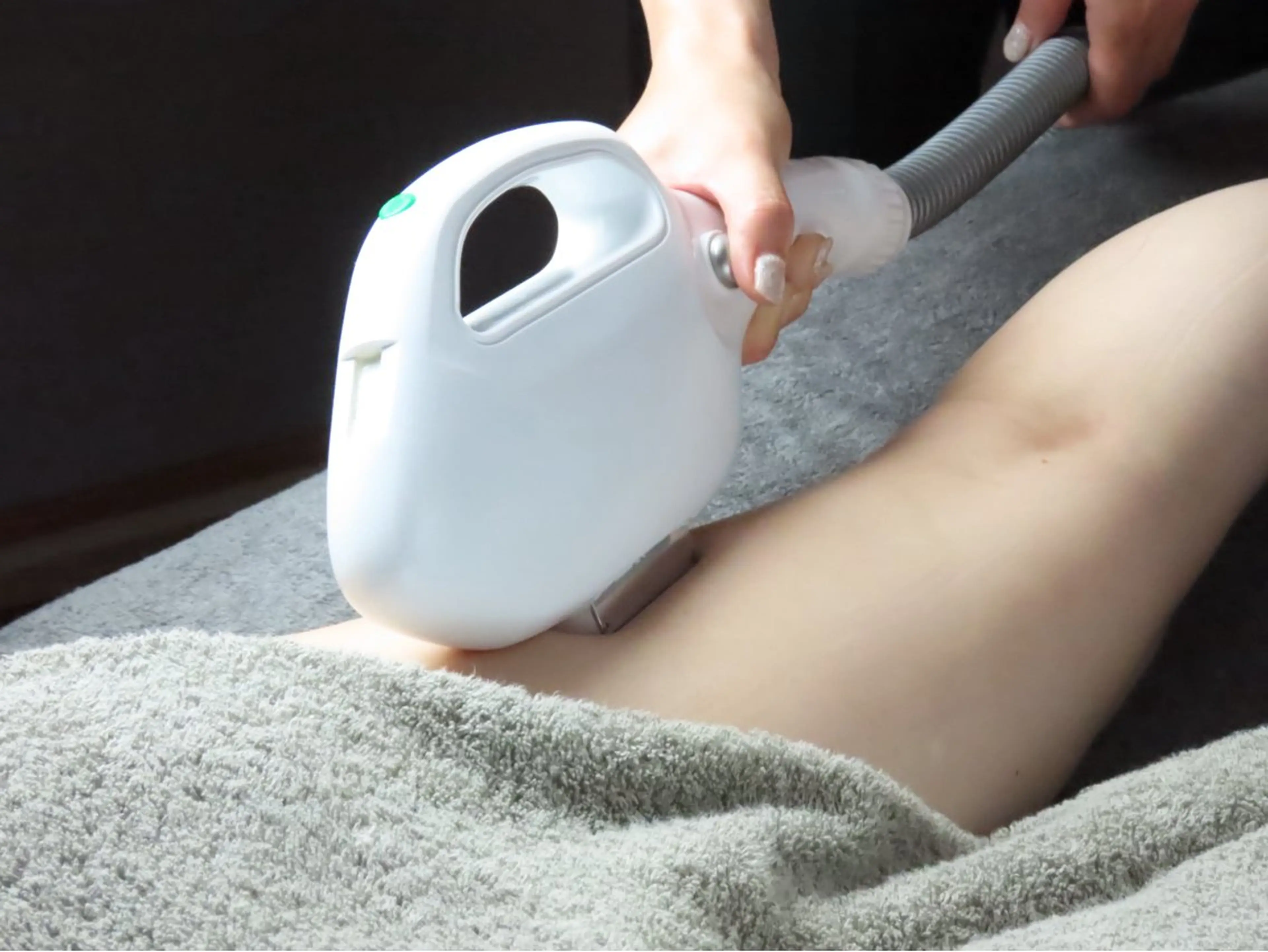 ミニモ平日限定価格★魅せる美肌へ…♡全身脱毛　顔・VIO込の写真