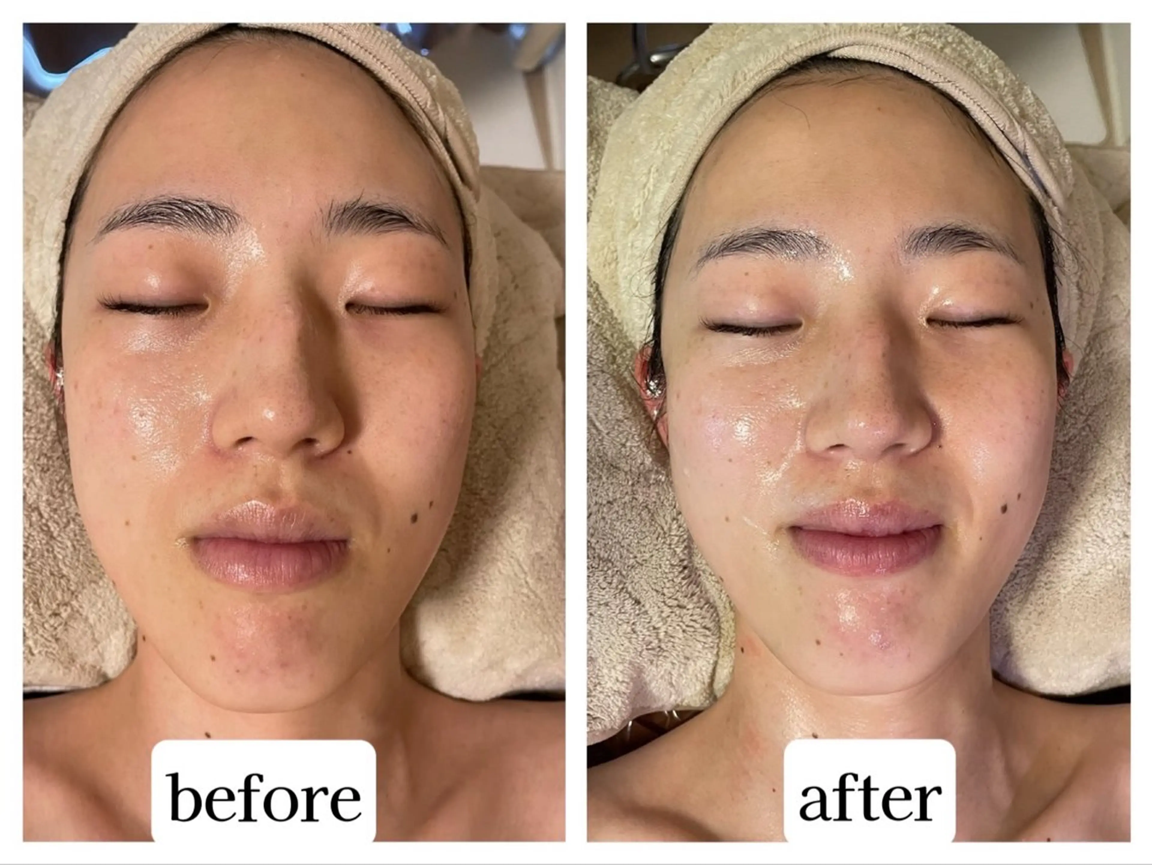 Eyebeauty 神コスパ×高技術❣️のエステ・リラクイメージ