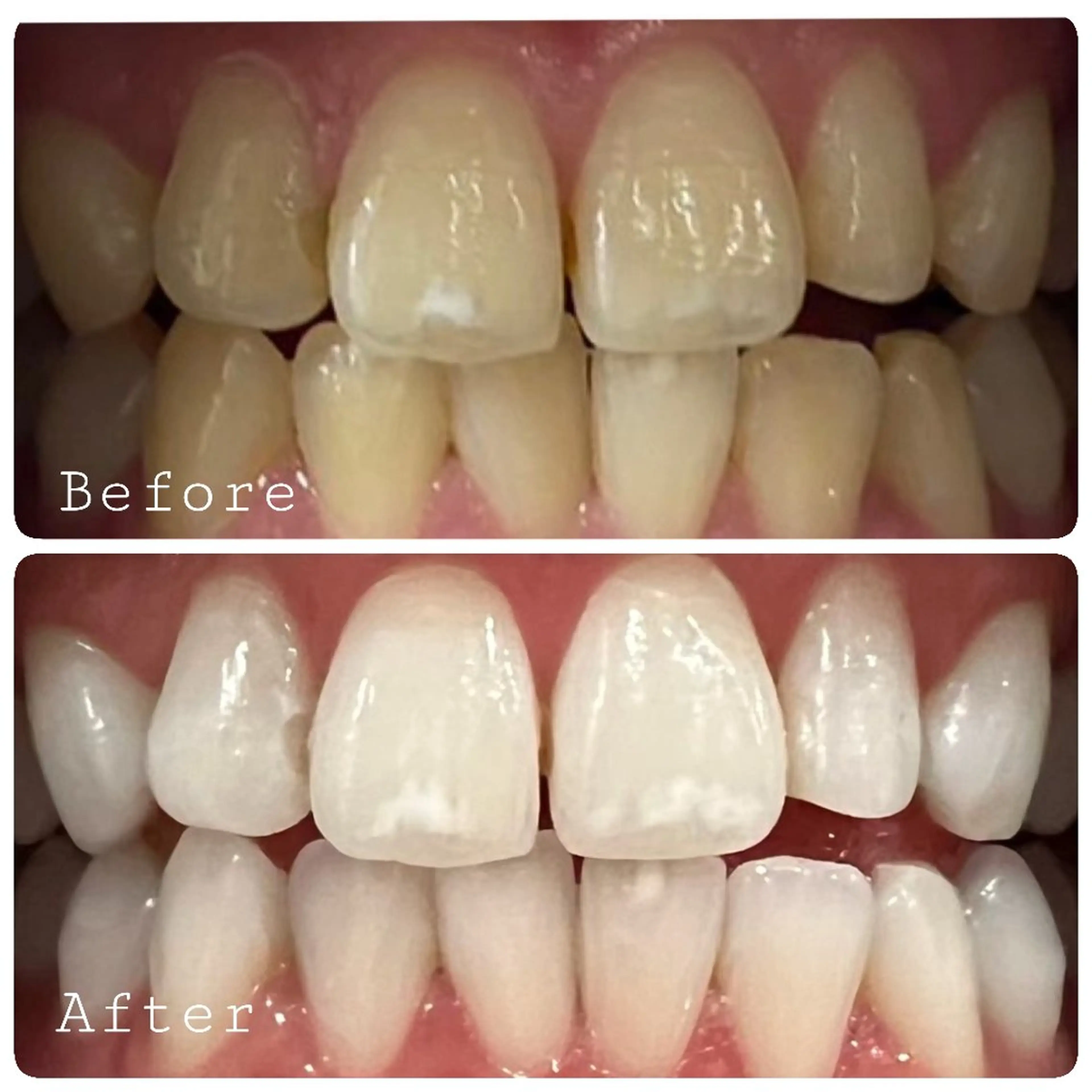 ほわいと あざぶのマツエク・マツパデザイン