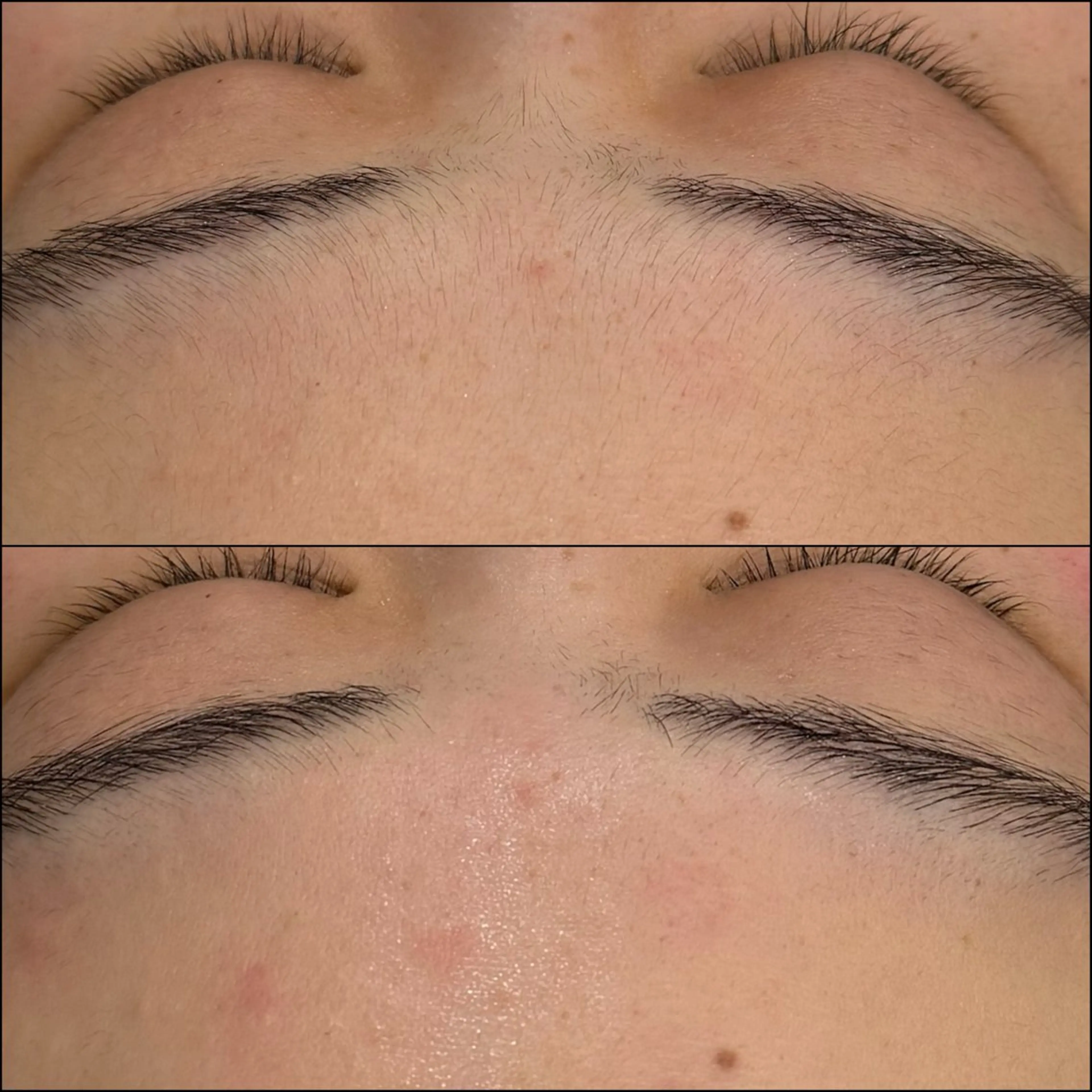 脱毛 LiZA エステティックサロンのエステ・リラクイメージ