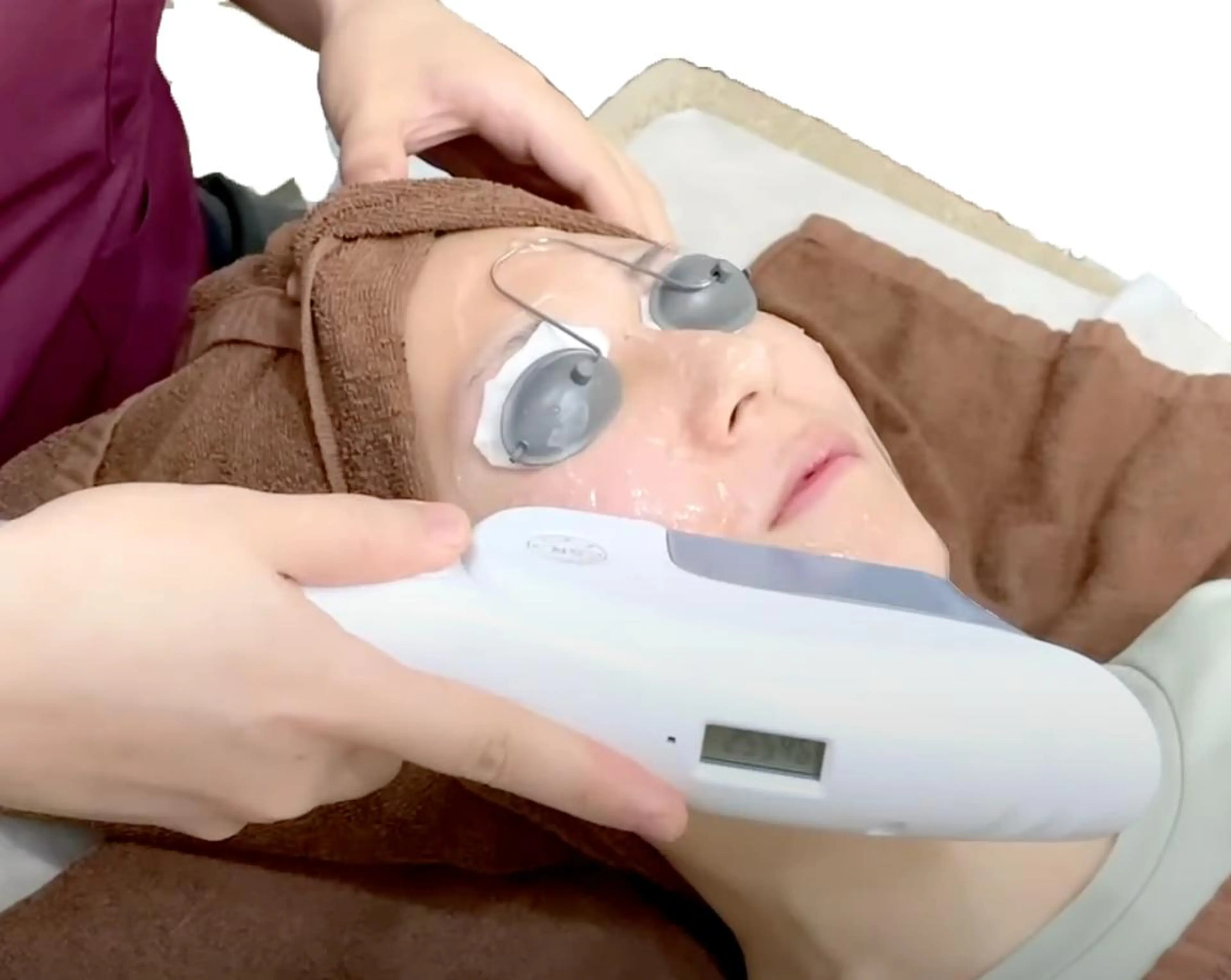 残り3名限定【シミ/肌荒れケア】60分⭐️IPL＋フェイシャルマッサージの写真