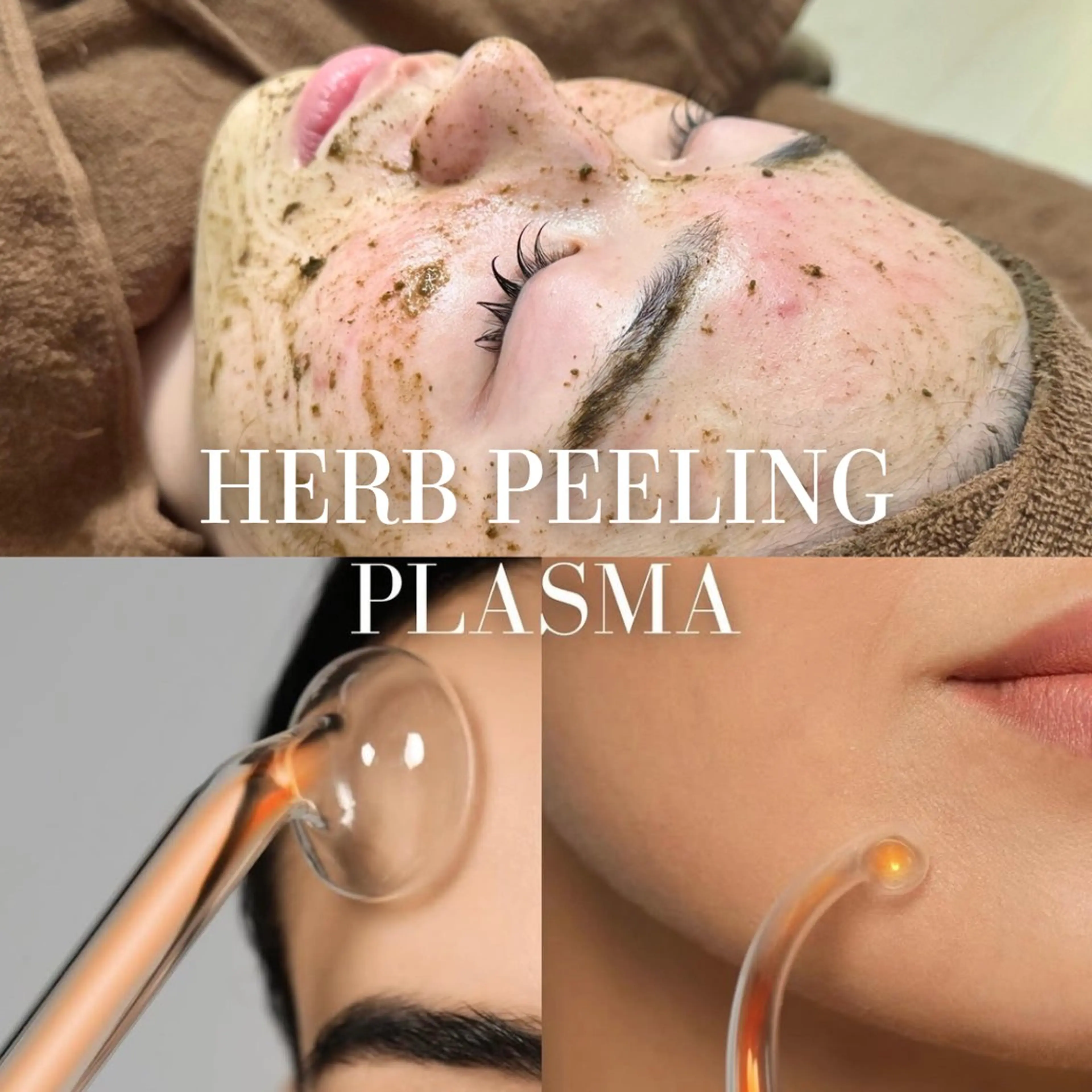 【本気の肌質改善】陶器肌ハーブピーリング×韓国プラズマシャワー★最強ニキビケアセット！の写真