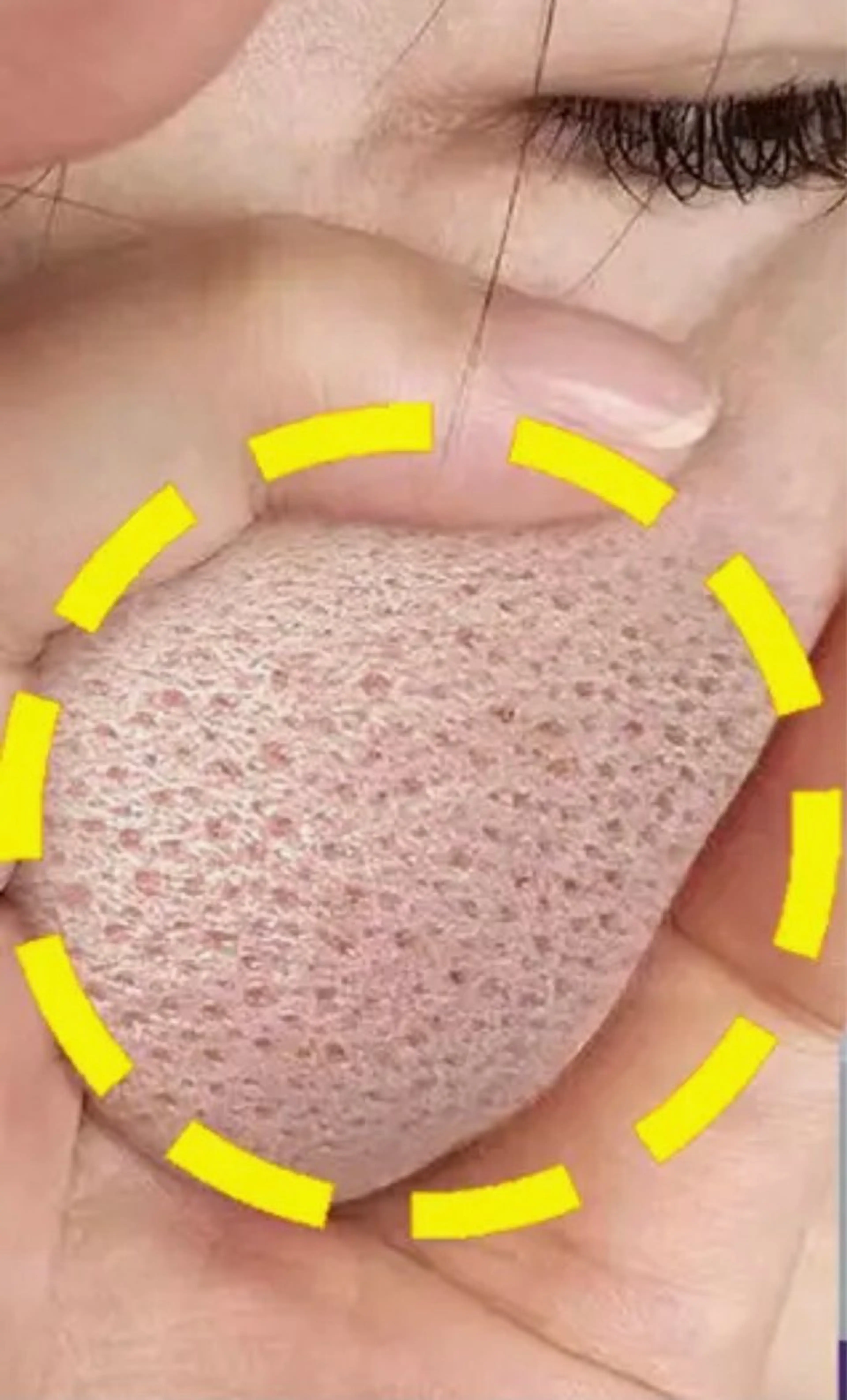 エステ ☺ハーブピール💕 ソフィアカロン💖のエステ・リラクイメージ