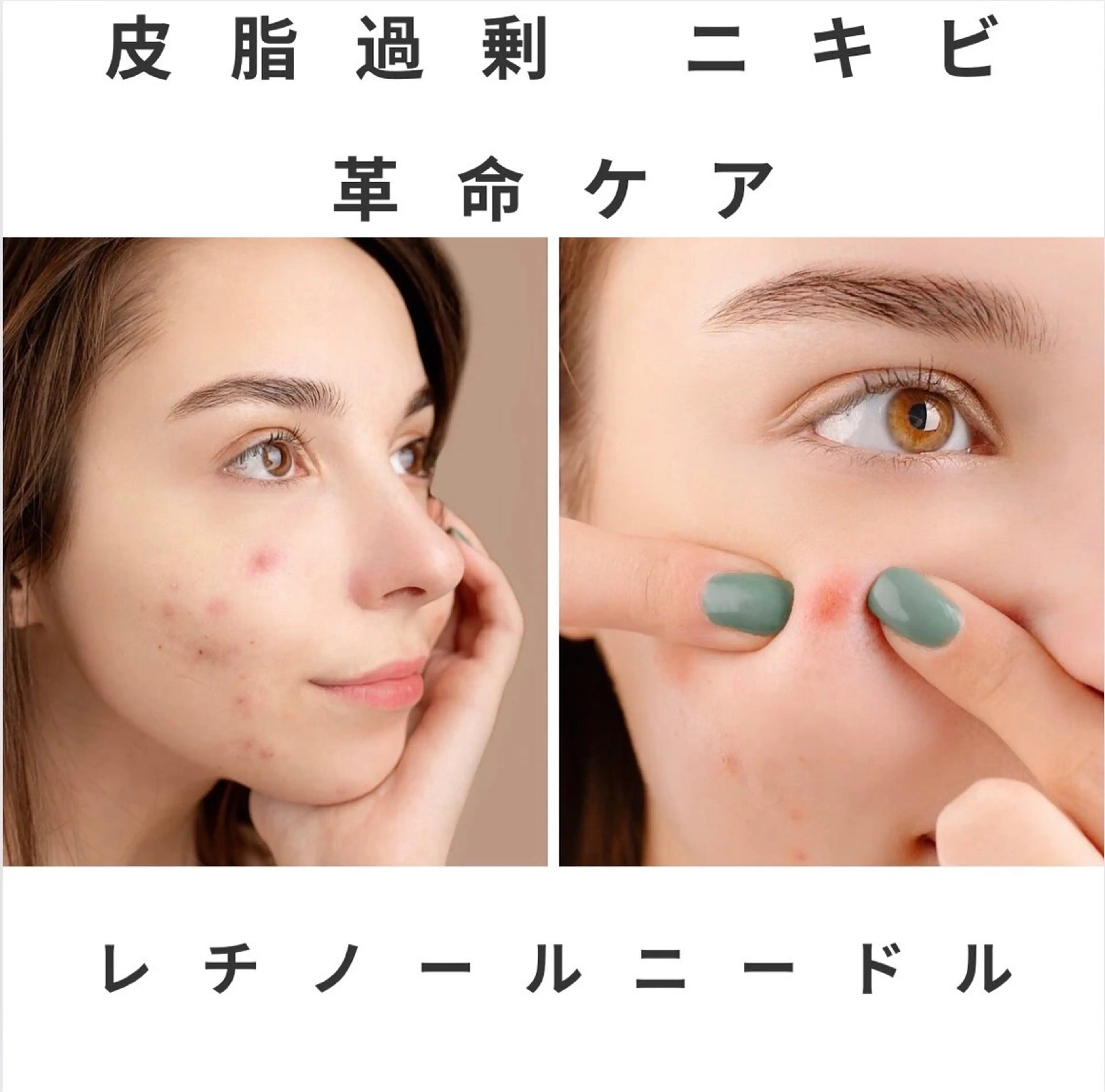 【皮脂リセット集中ケア90分】顔のテカリ終わりにしよう！1回35.600円→8.500円の写真