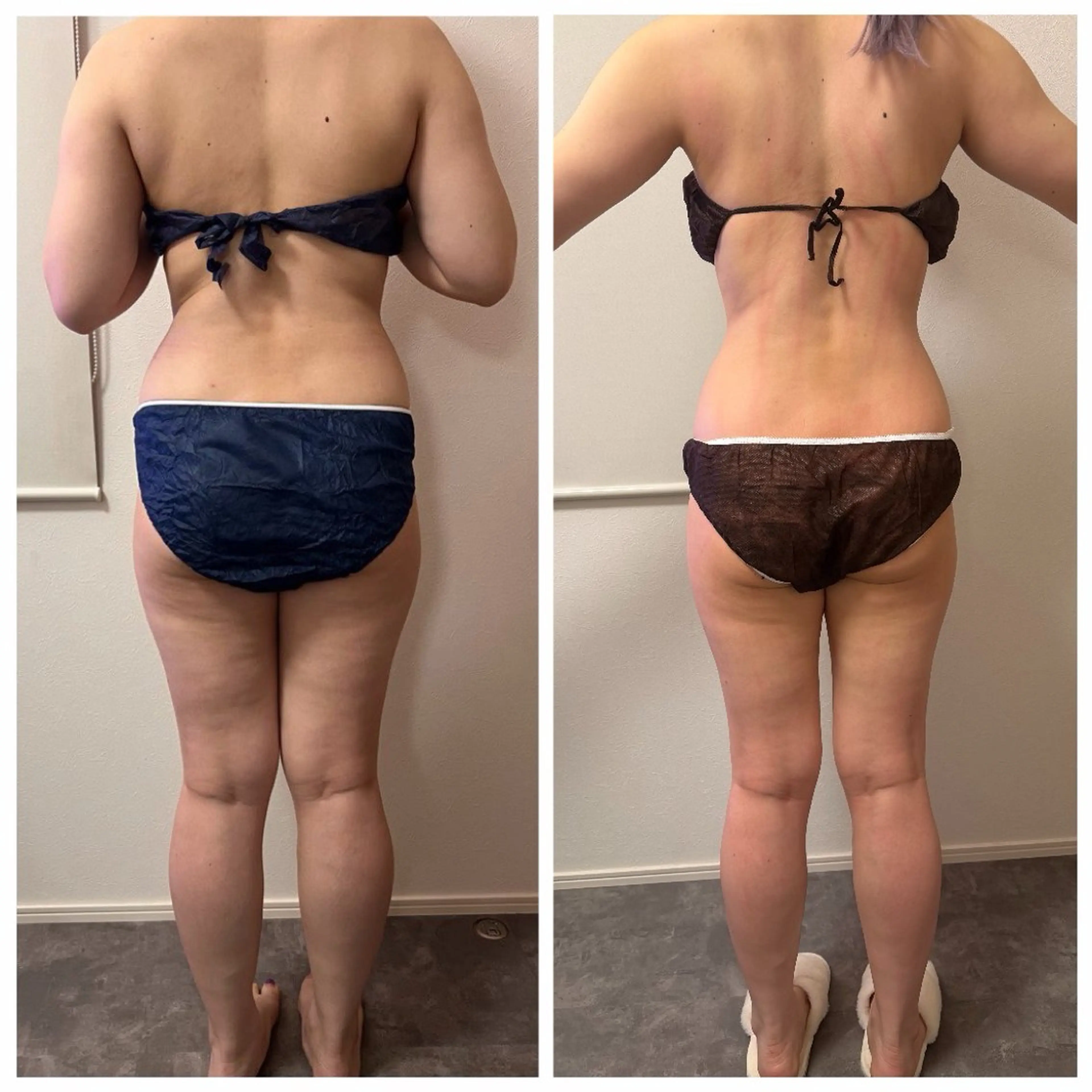 エステ 本気で痩せたい方へ 痩身専門サロンのエステ・リラクイメージ