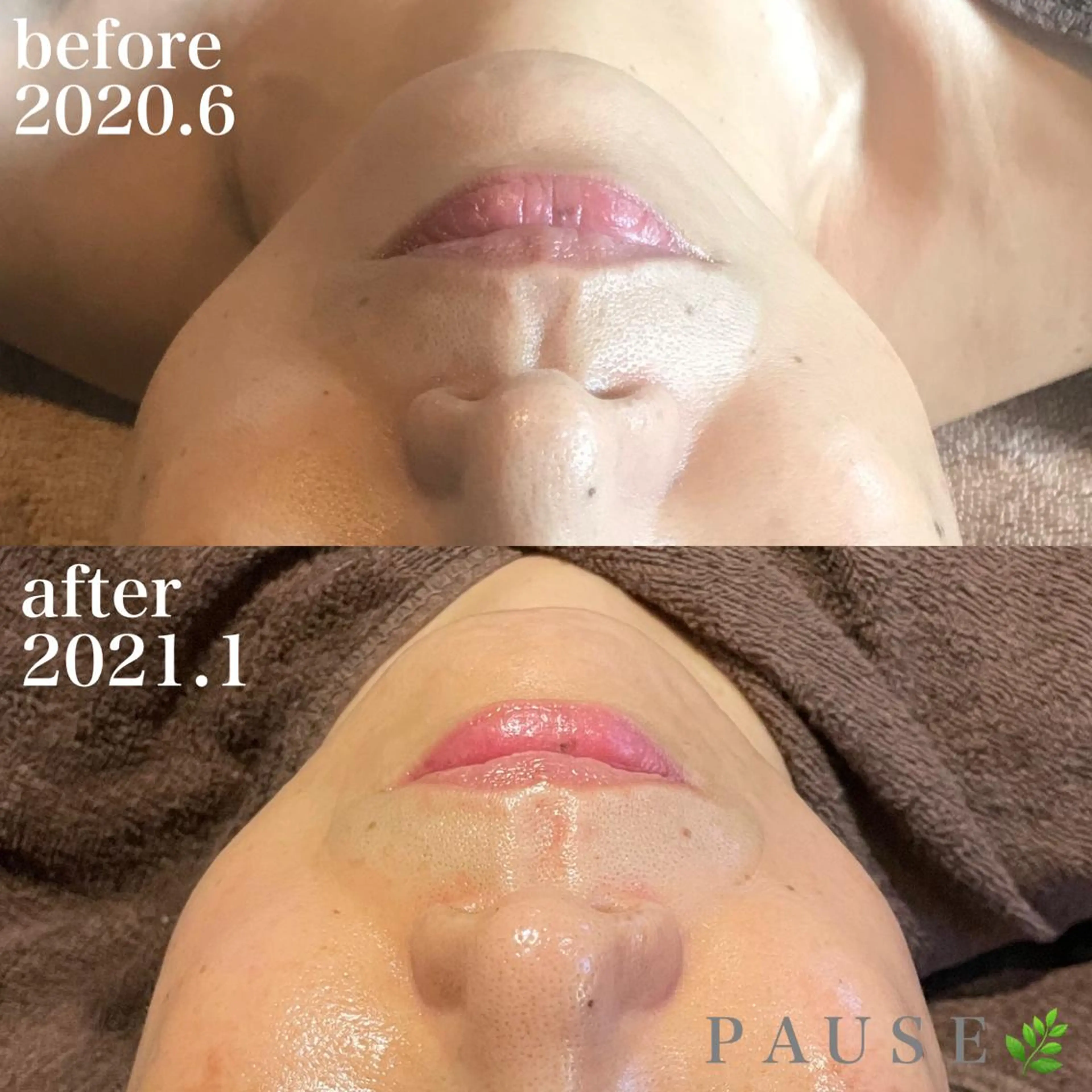 エステ 浜野 恵美のエステ・リラクイメージ