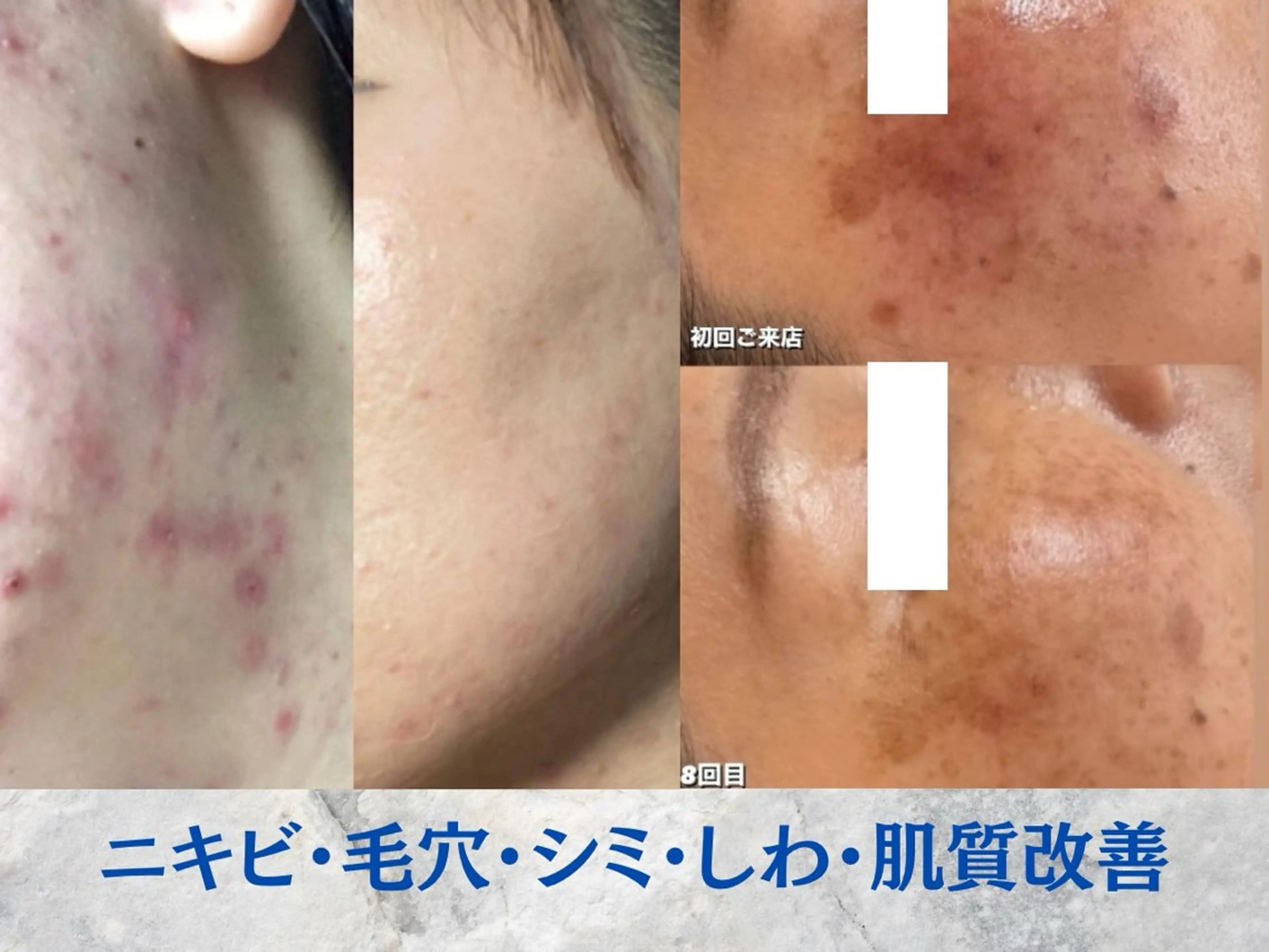 エステ リラク Esthetics 911横浜のエステ・リラクイメージ