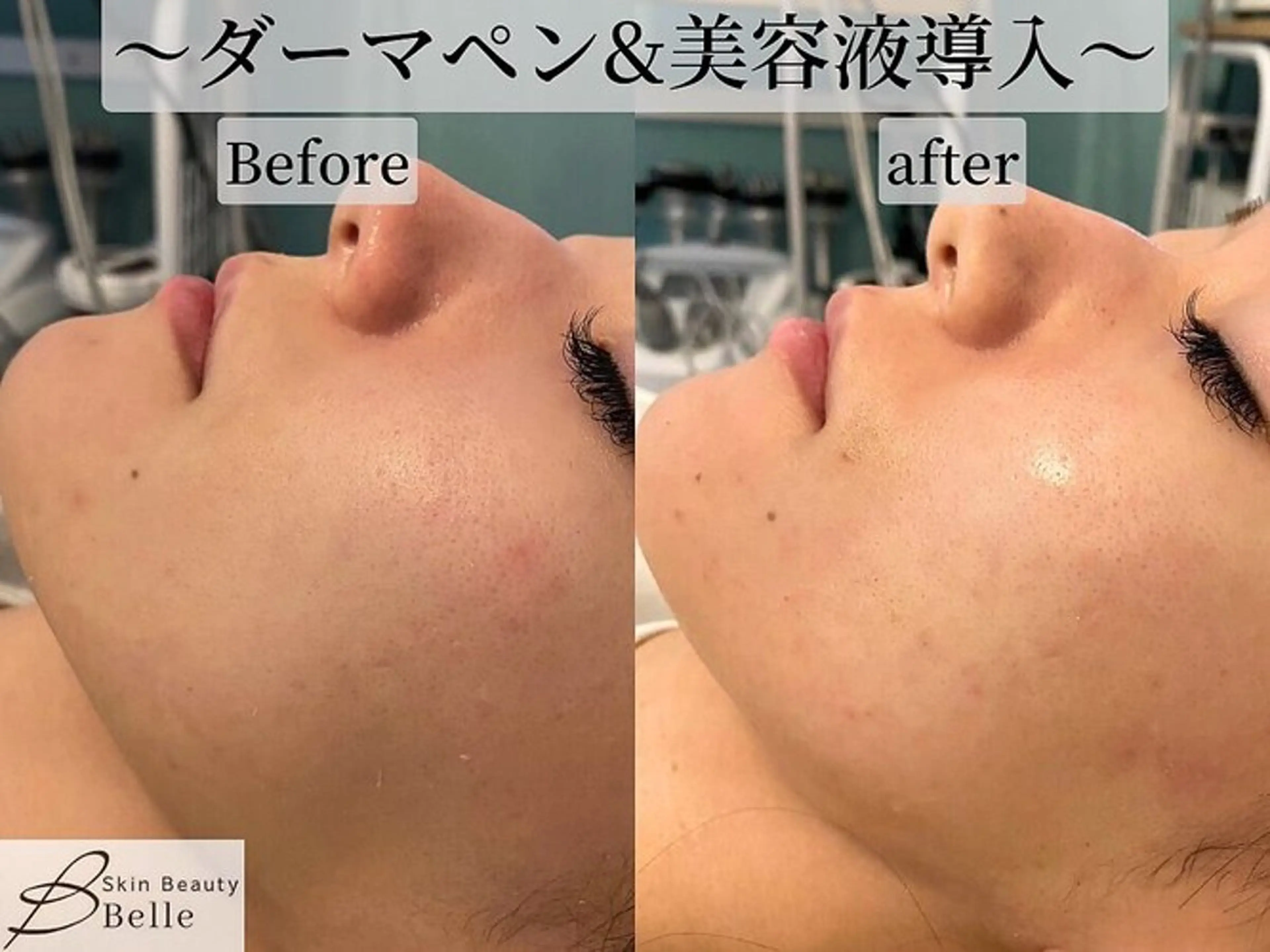 エステ 韓国肌管理Belle志木店所属・中谷 彩華のエステ・リラクイメージ