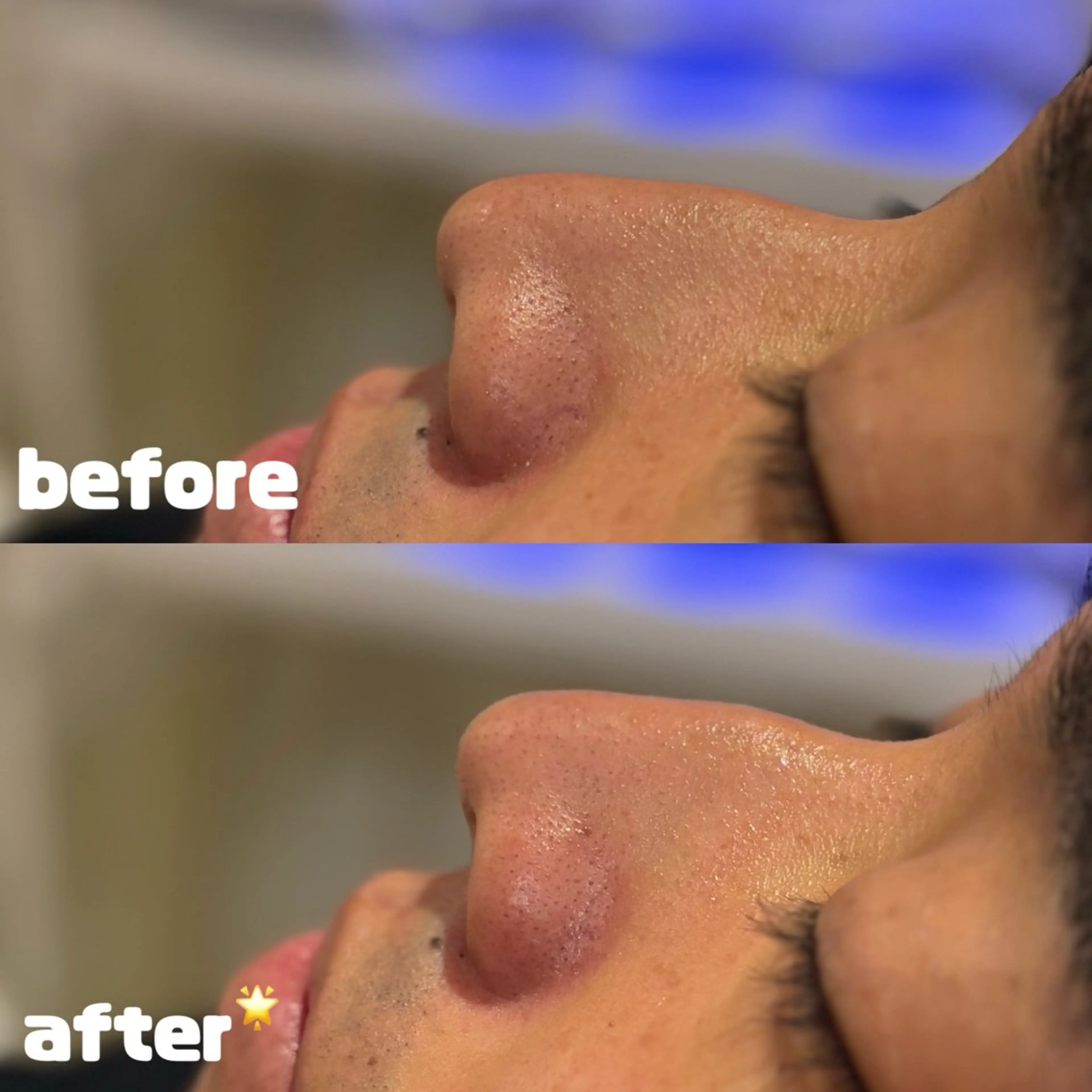 エステ HAREHADA 🫧/ Ibukiのその他イメージ