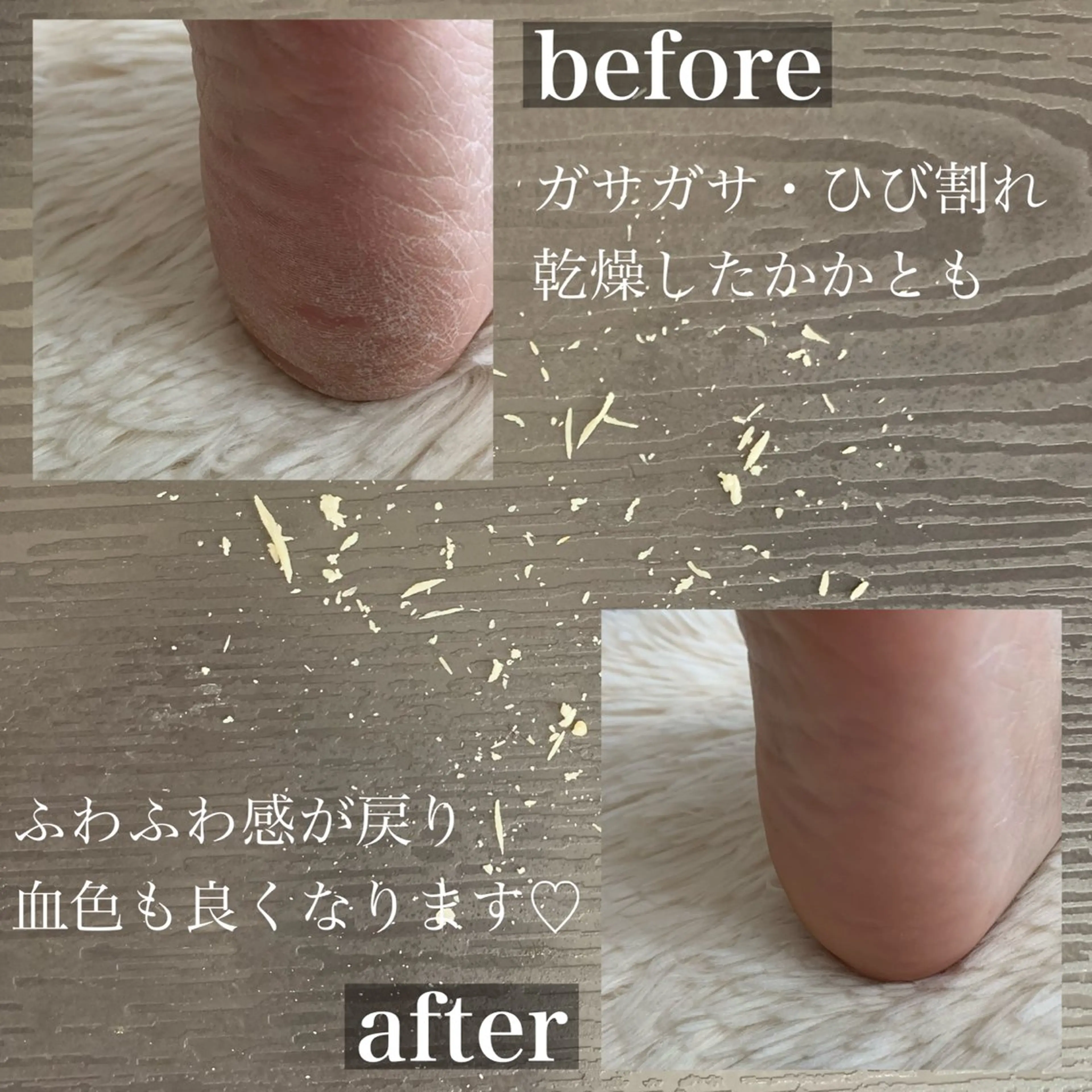 フット🦶🏻足裏かかと角質ケアの写真