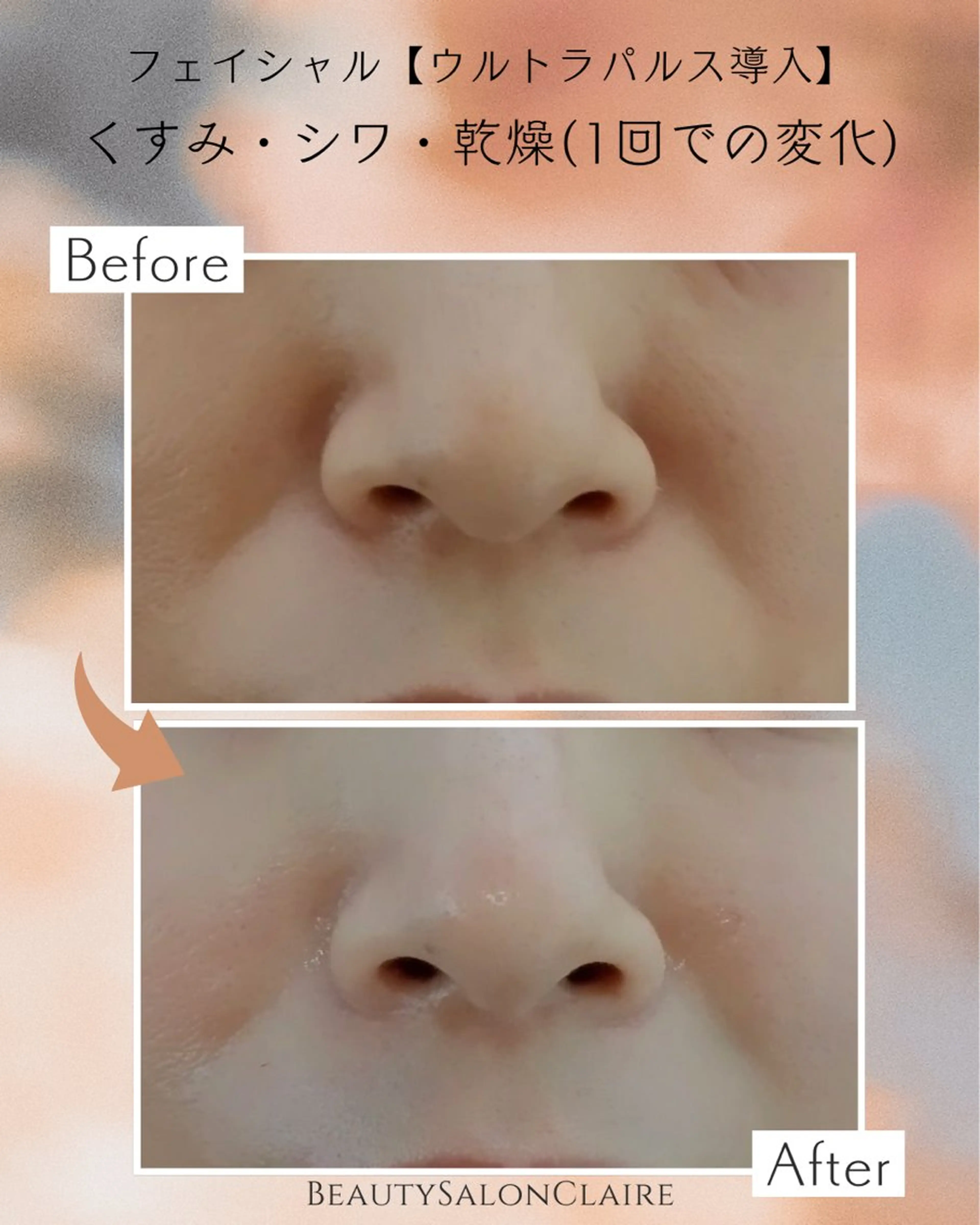 エステ 口コミ★5獲得 Claire鈴木のエステ・リラクイメージ