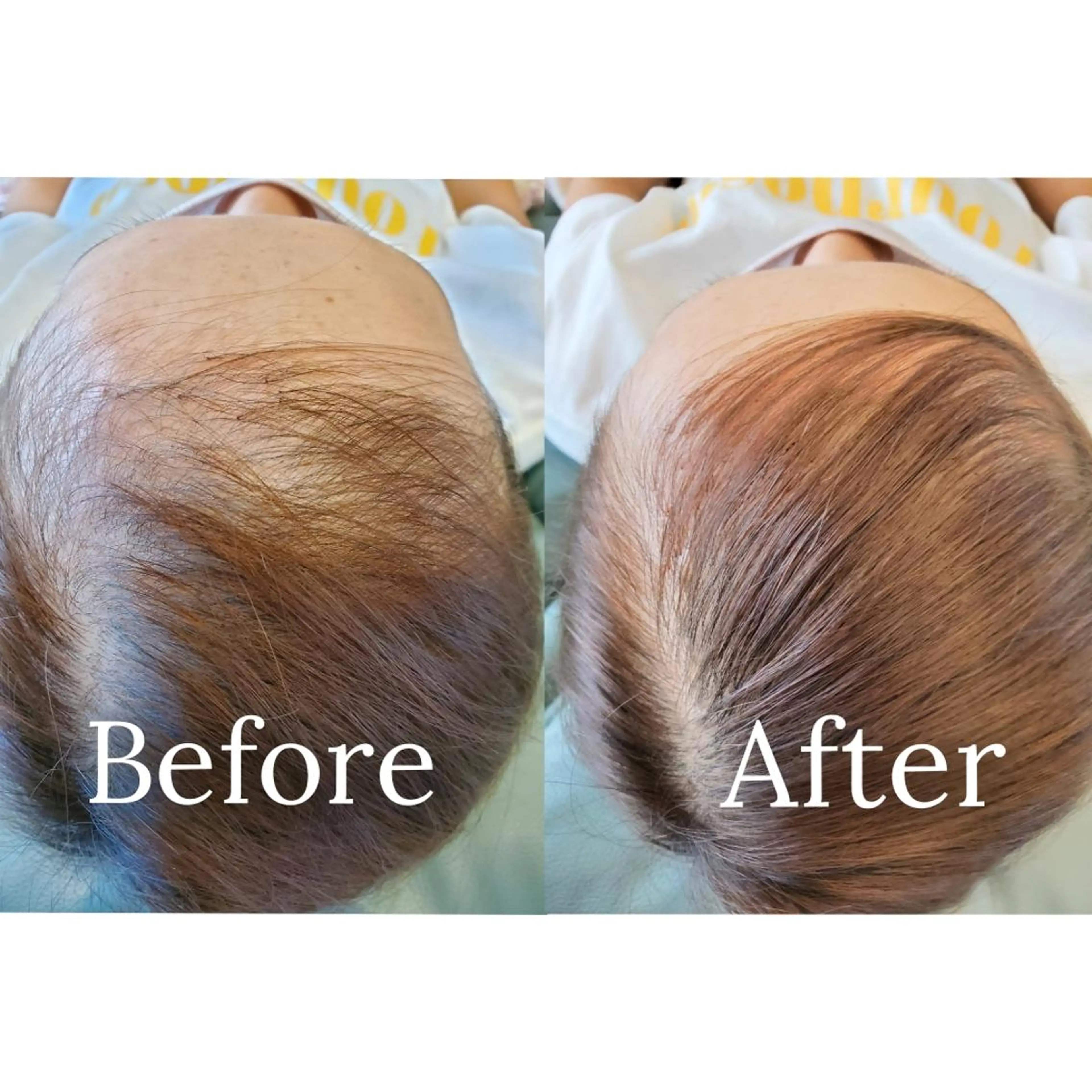 歯科提携セルフダック 宇都宮駒生店のエステ・リラクイメージ