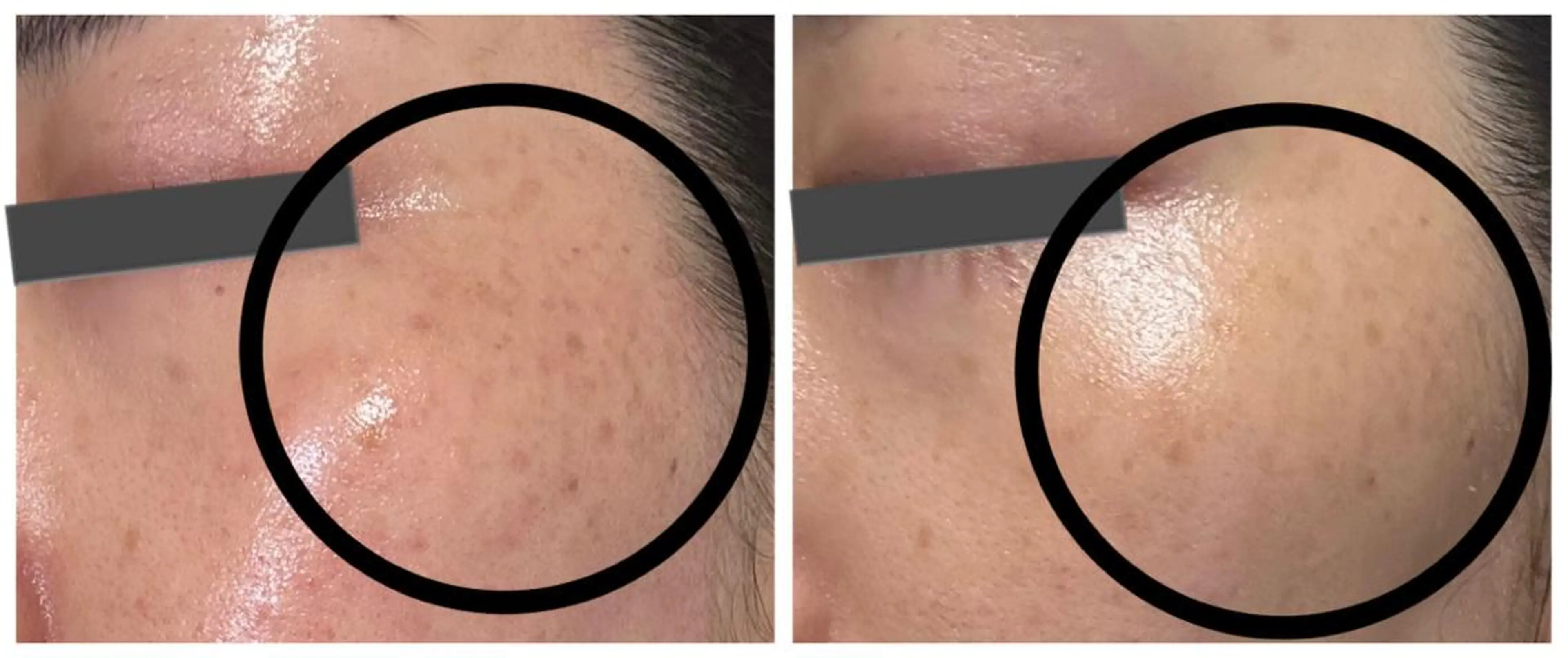 エステ リラク ベルフェリーチェ 早織のエステ・リラクイメージ