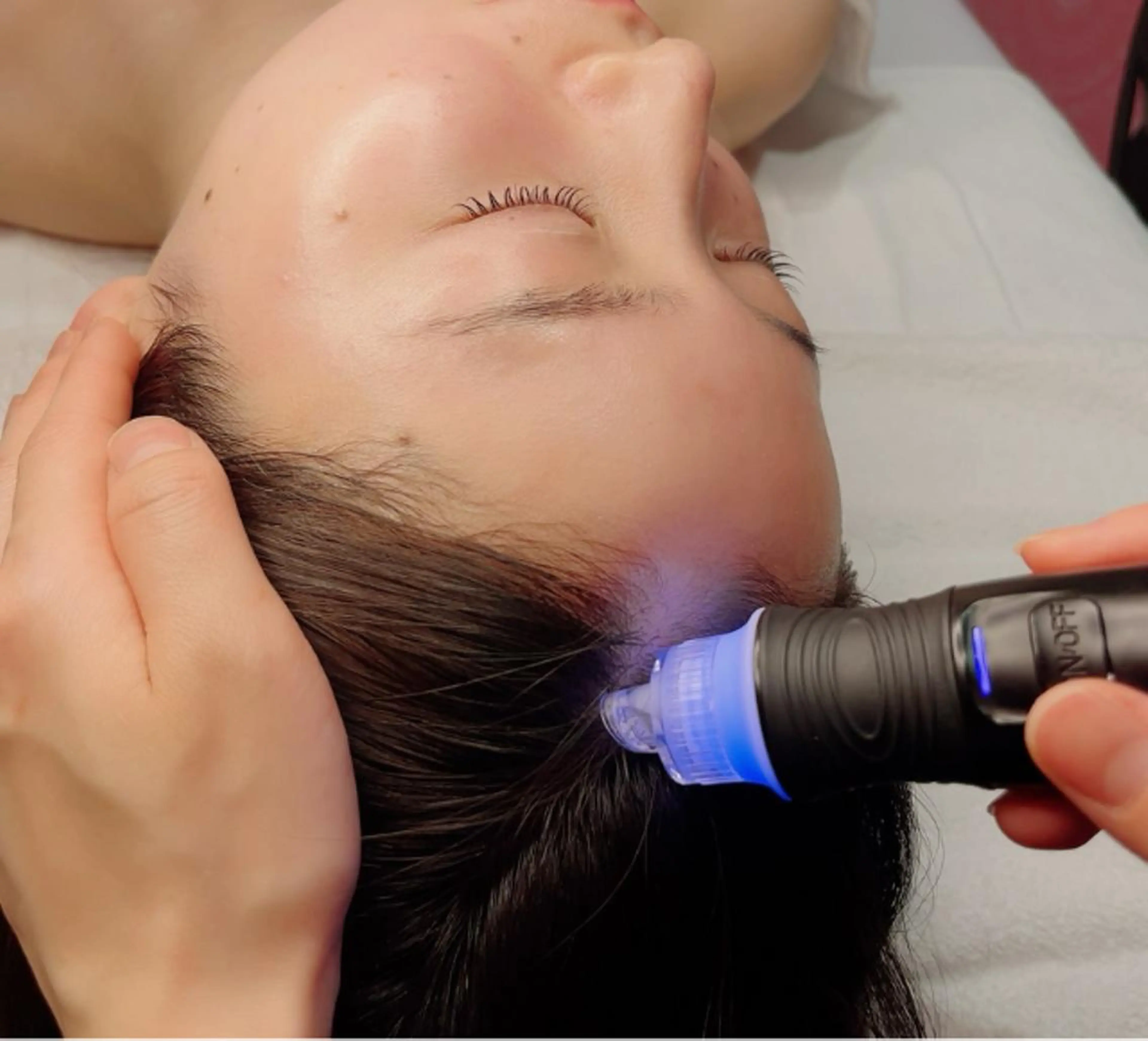 【20分コース】ヘッド洗浄🌿✨の写真