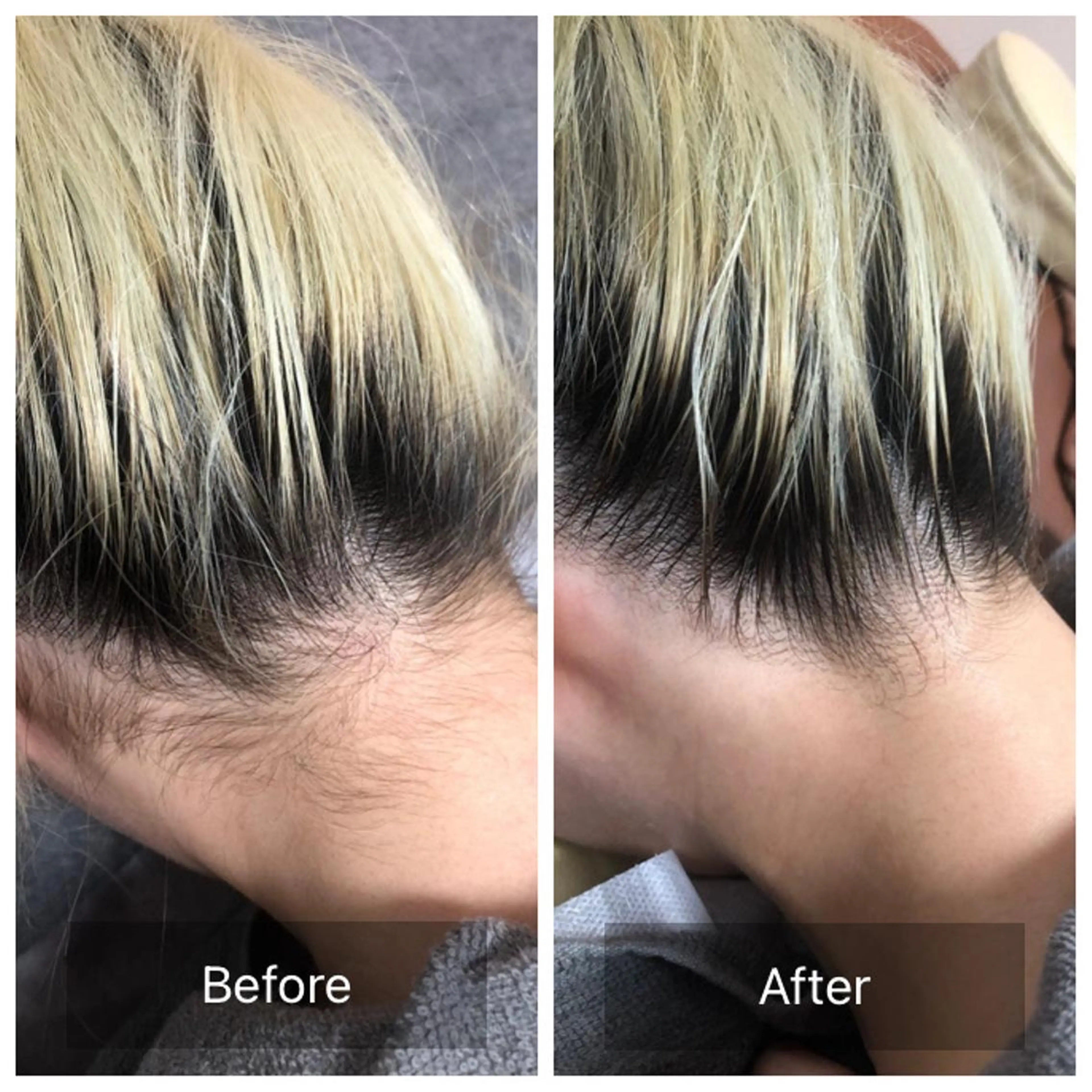 脱毛 Lumiere despoir所属・Lumiere despoirのエステ・リラクイメージ