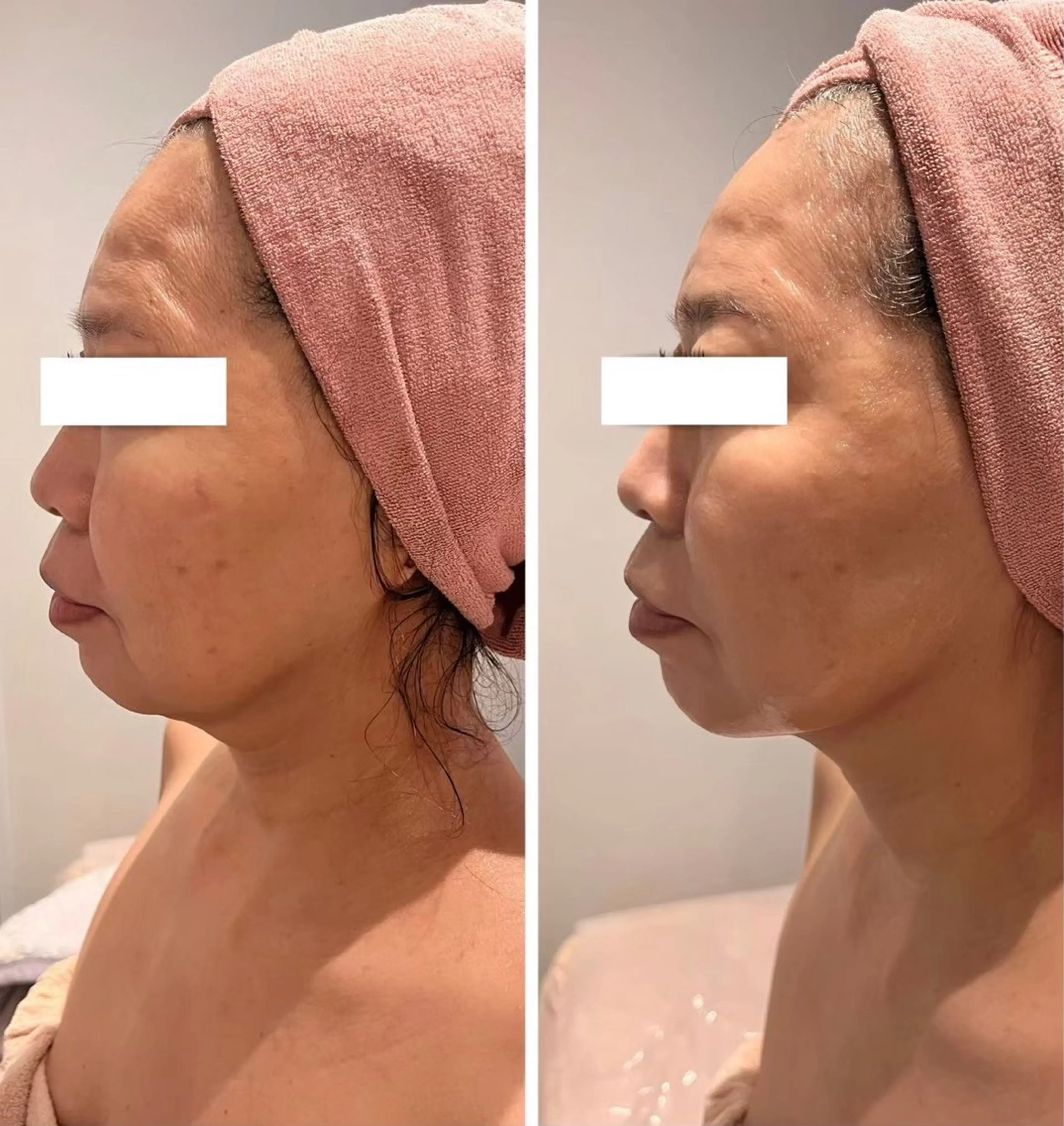 エステ エムフルール リラク＆エステのエステ・リラクイメージ