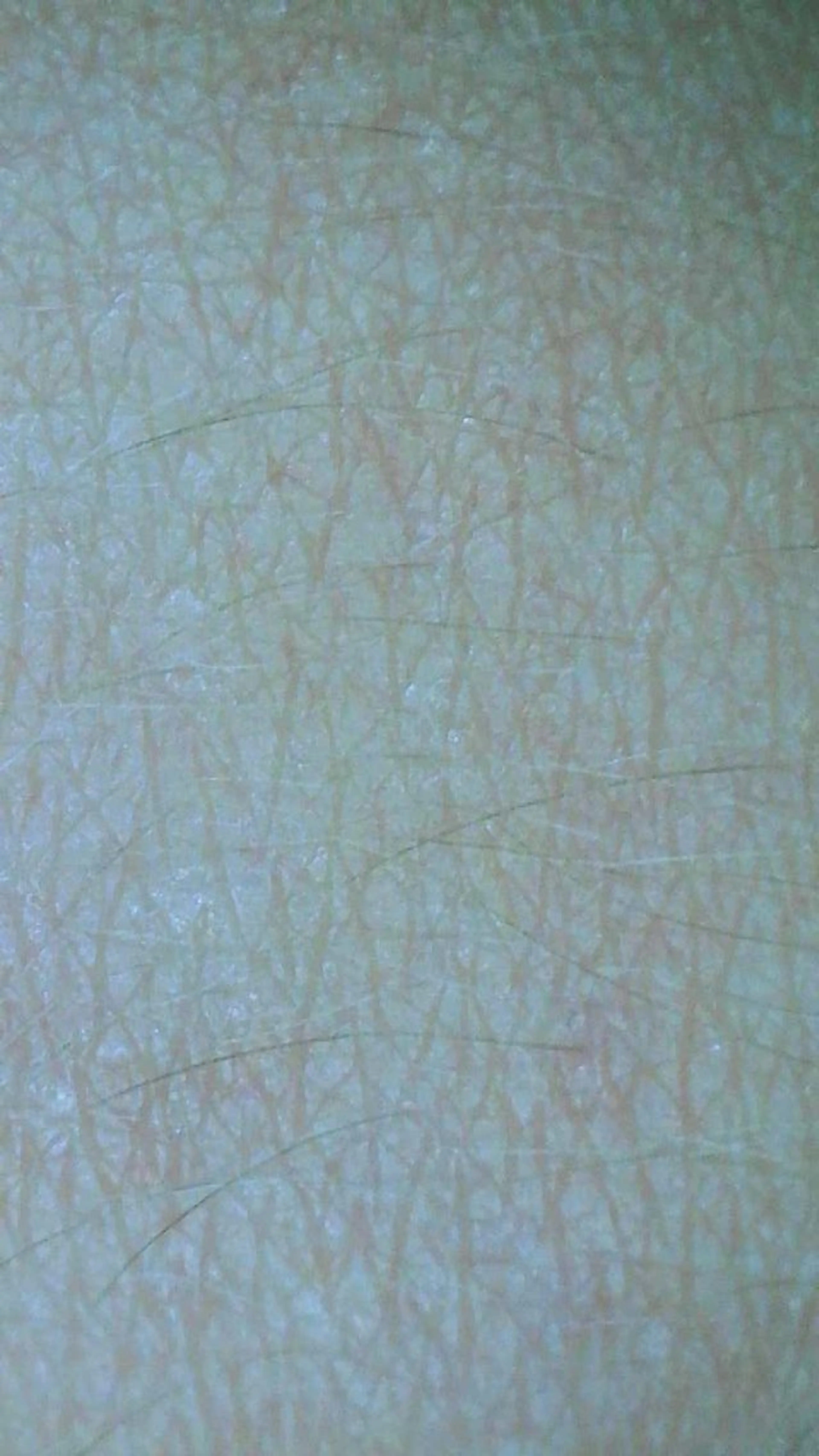 【白山〜野々市】美容 整体PONU(ポヌ)のエステ・リラクイメージ