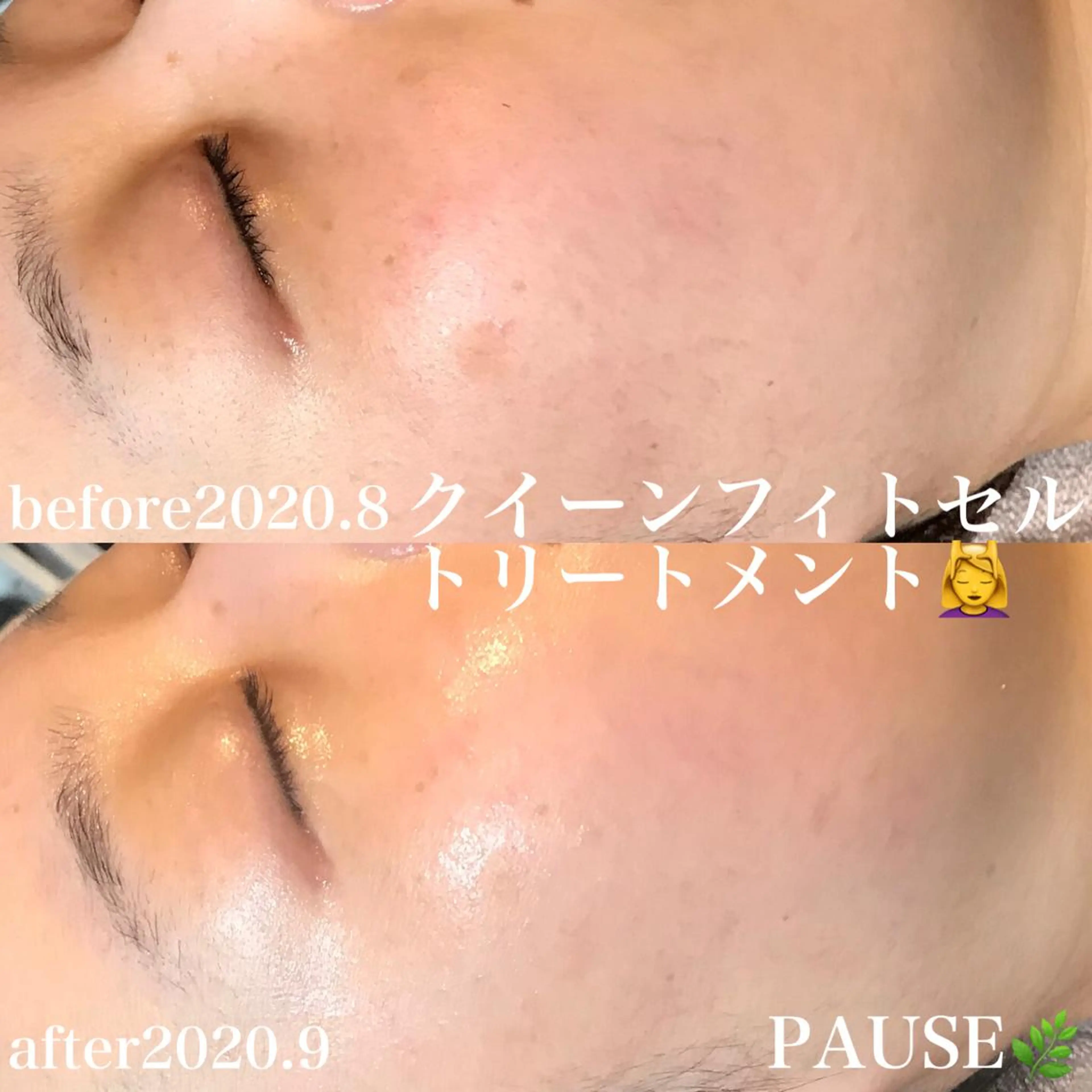 エステ 浜野 恵美のエステ・リラクイメージ