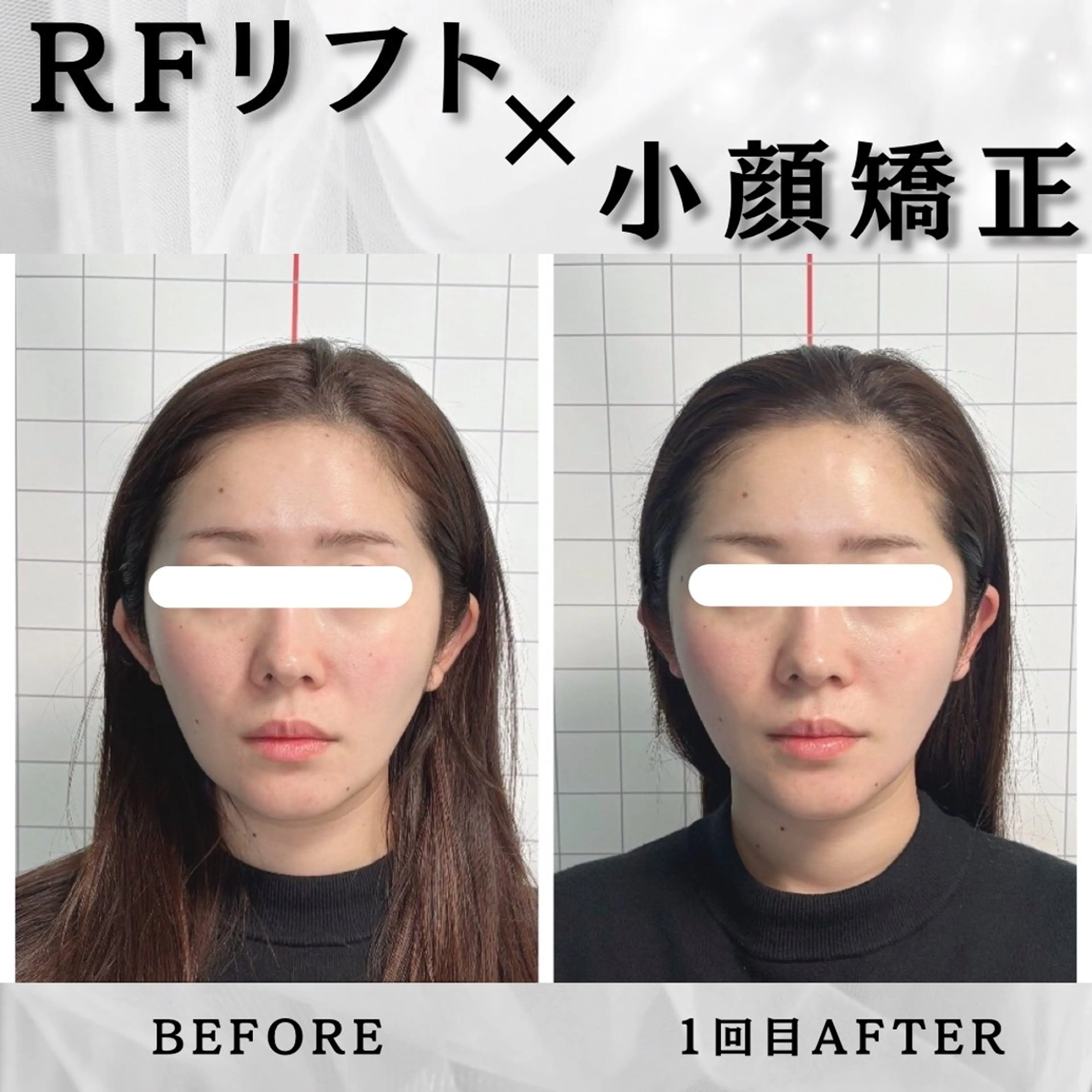 エステ リラク 小顔矯正専門店 【RED】池田のエステ・リラクイメージ