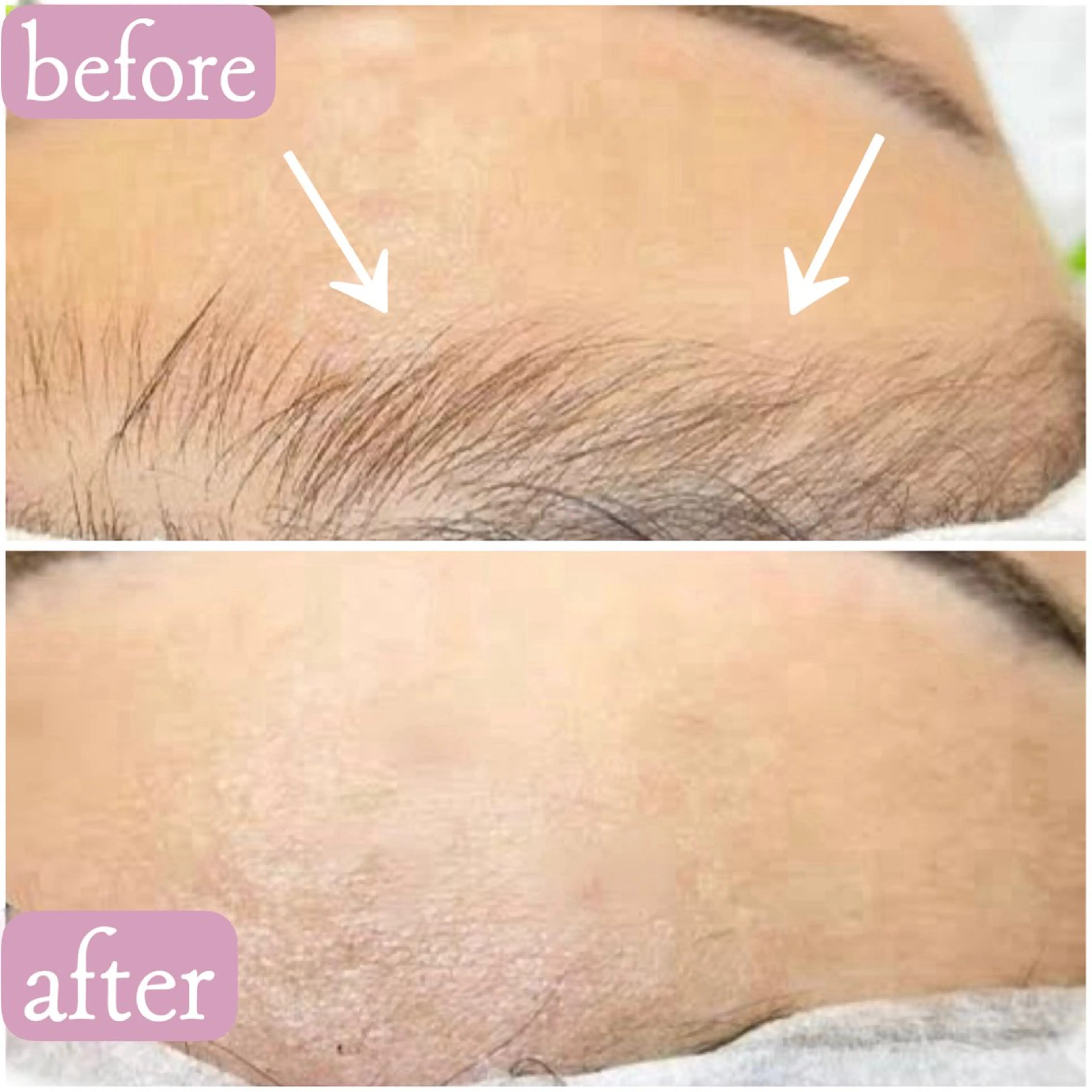 Total beauty salon  Brilliant所属・ROCO yuiの眉毛・アイブロウイメージ