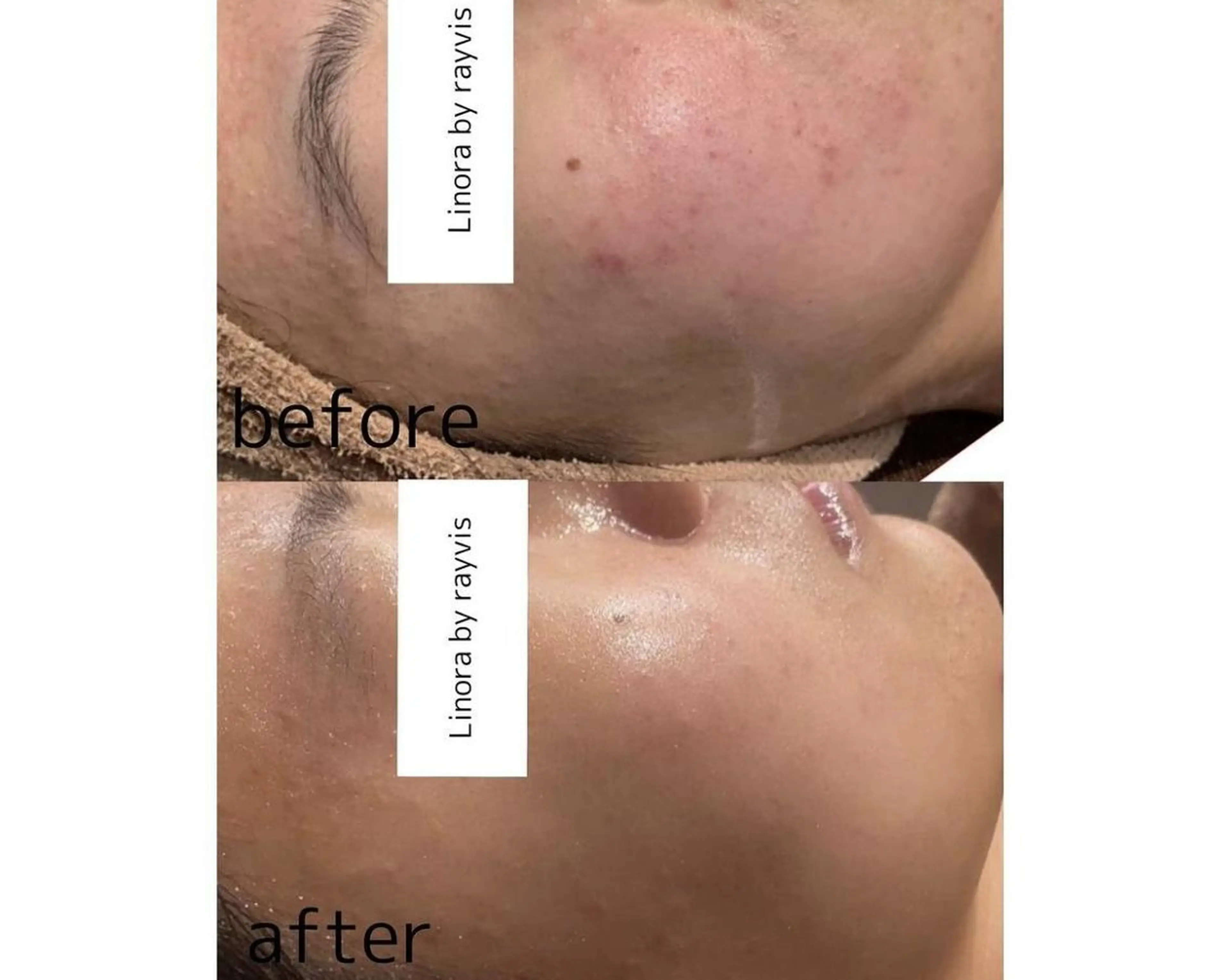 エステ 👑Linolaby RAYVIS👑⭐️のエステ・リラクイメージ