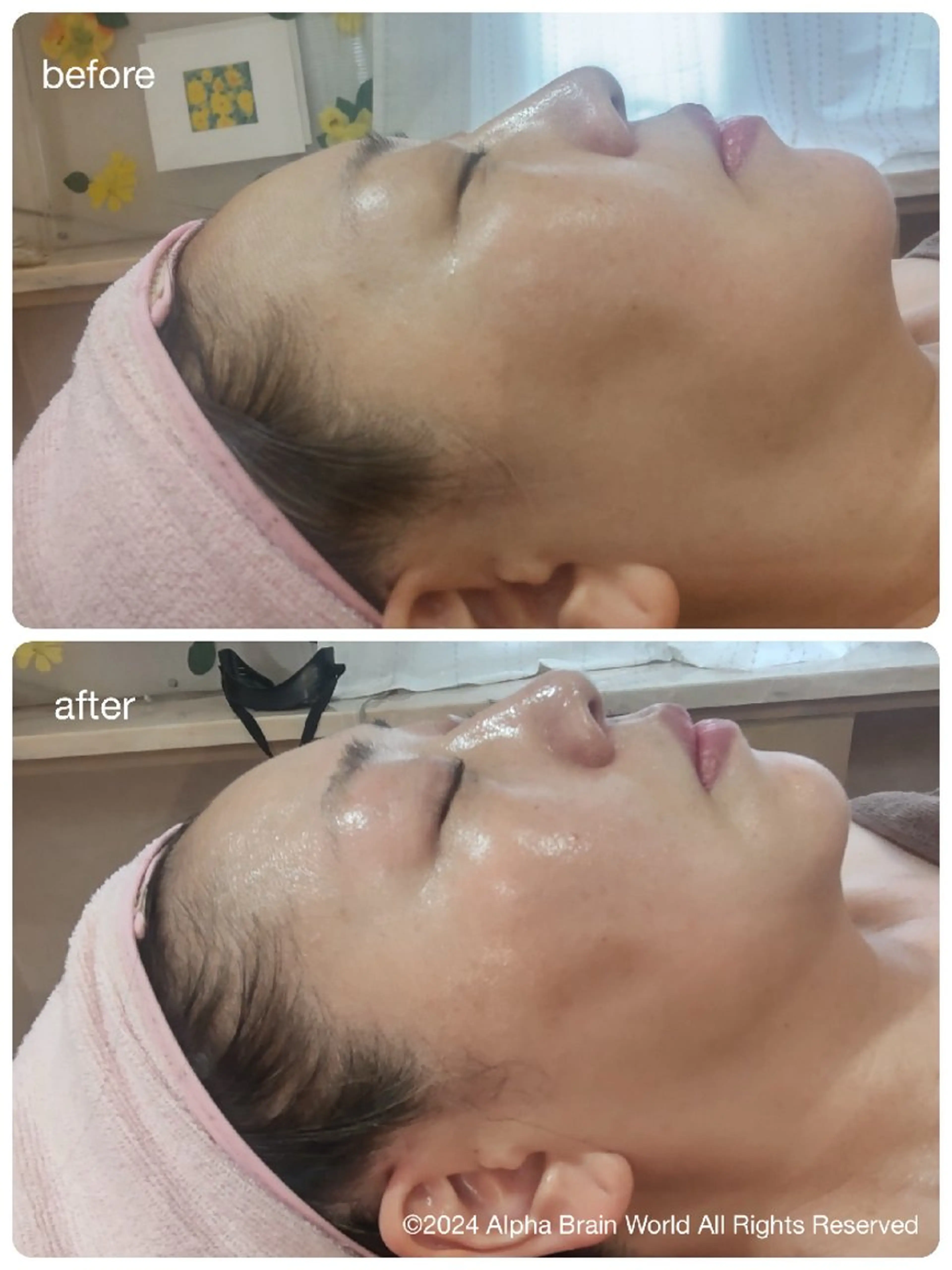 脱毛/美肌【皮膚科看 護師経営】ラベニールのエステ・リラクイメージ