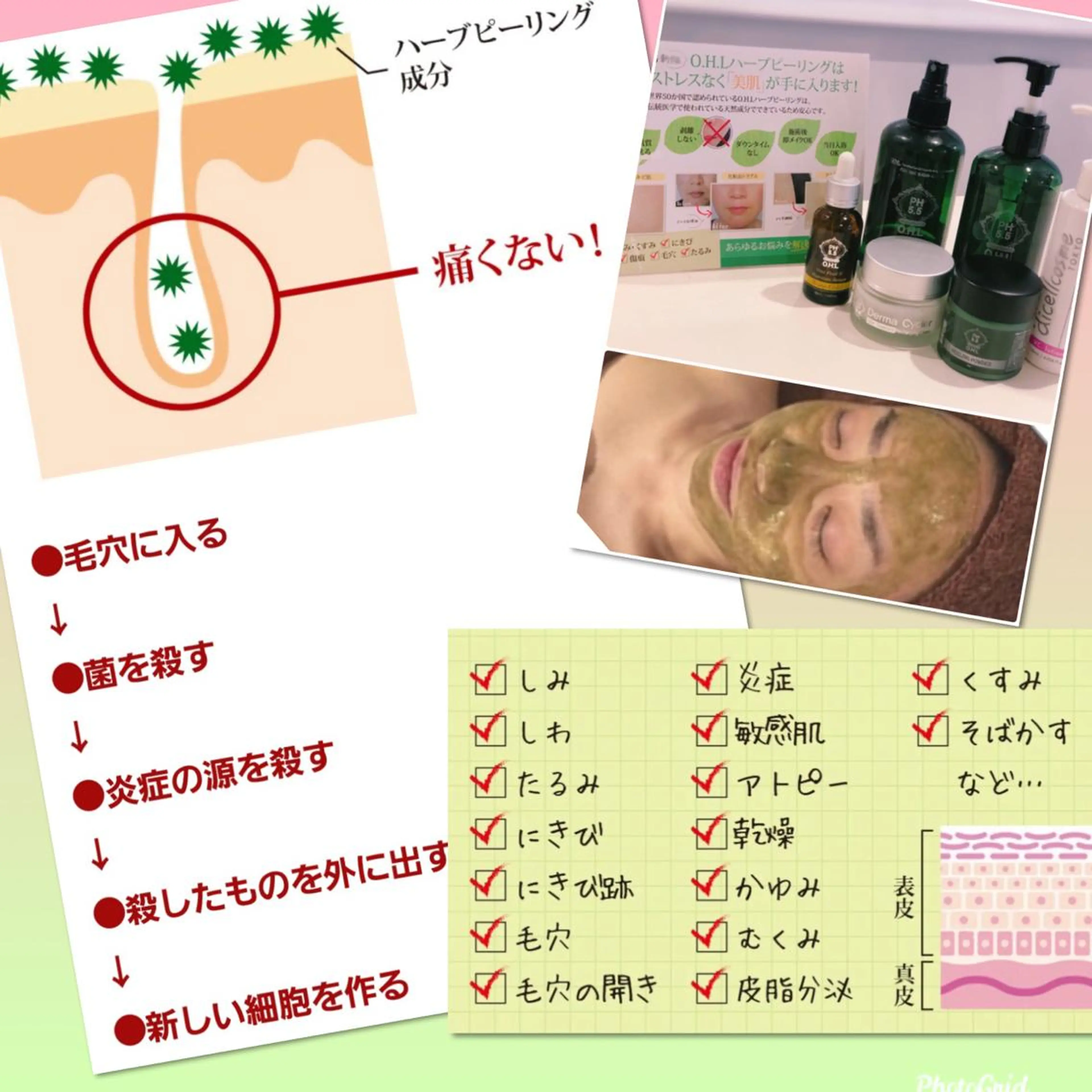 エステ 【リベルハーブピーリング認定店】敏感肌・美白脱毛専門店Dione立川店所属・Dione 立川店のエステ・リラクイメージ