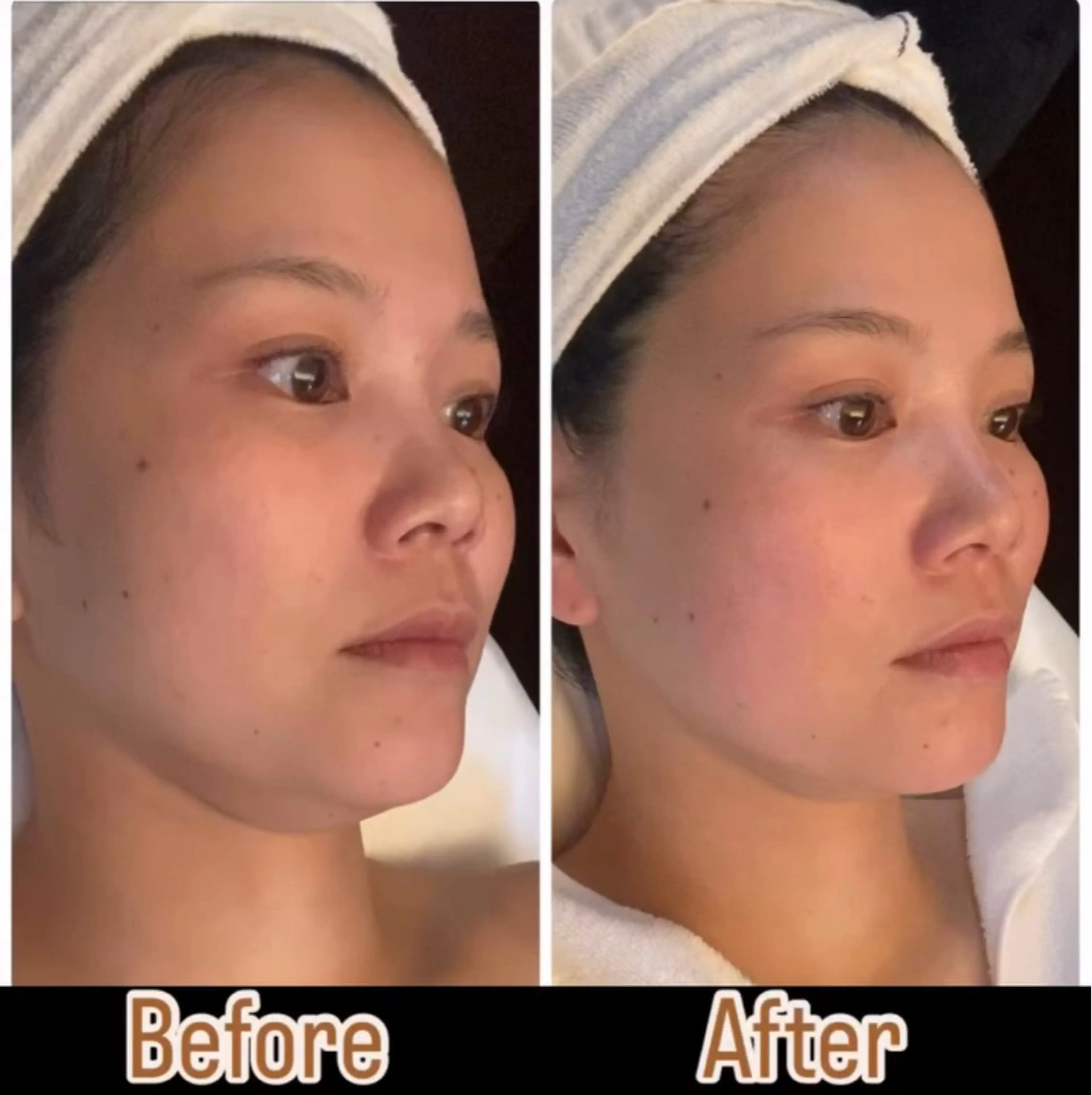 エステ ビューティーサロン　プリズム所属・久留本 茜のエステ・リラクイメージ