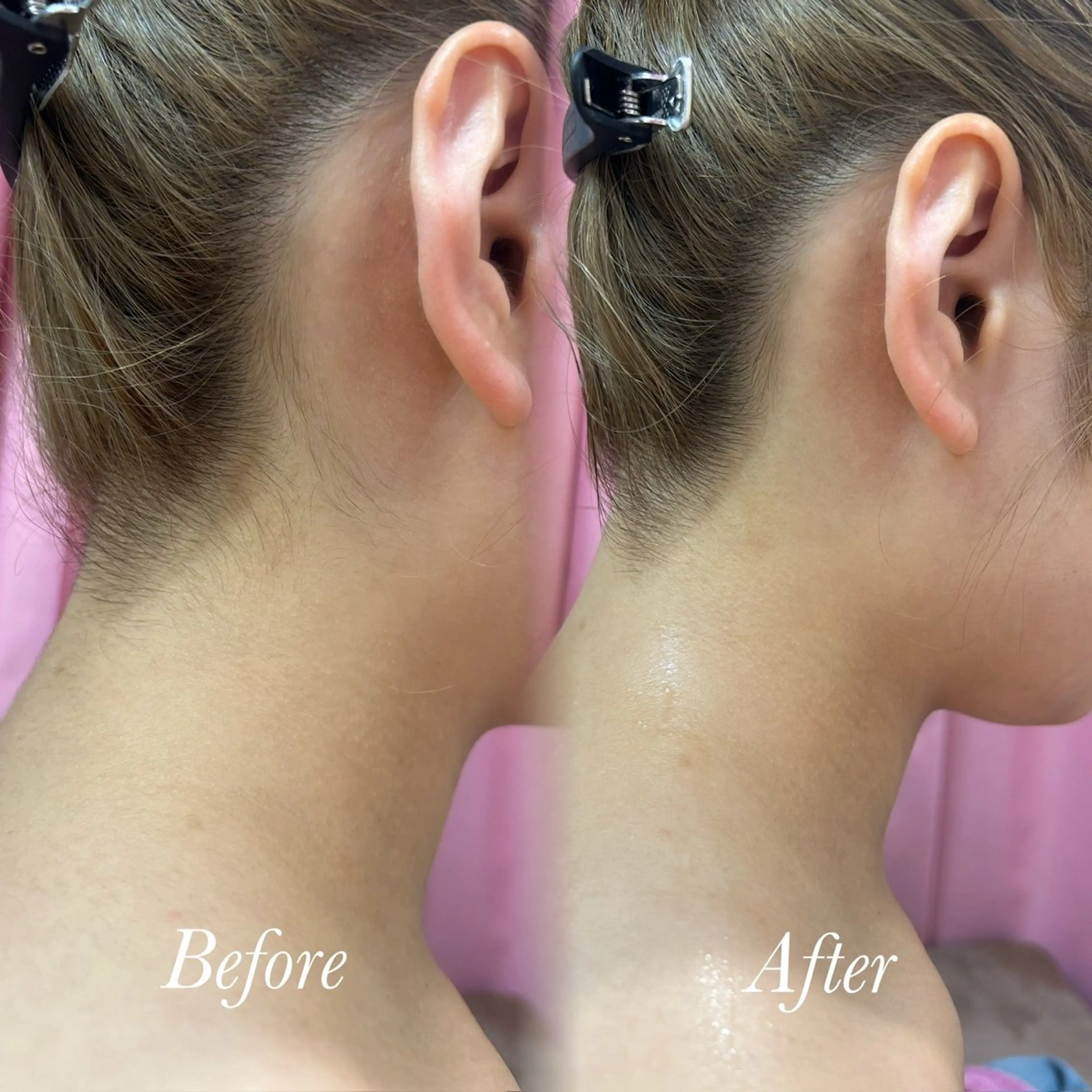 🫧美しい素肌へ🫧 今成柚乃のその他イメージ