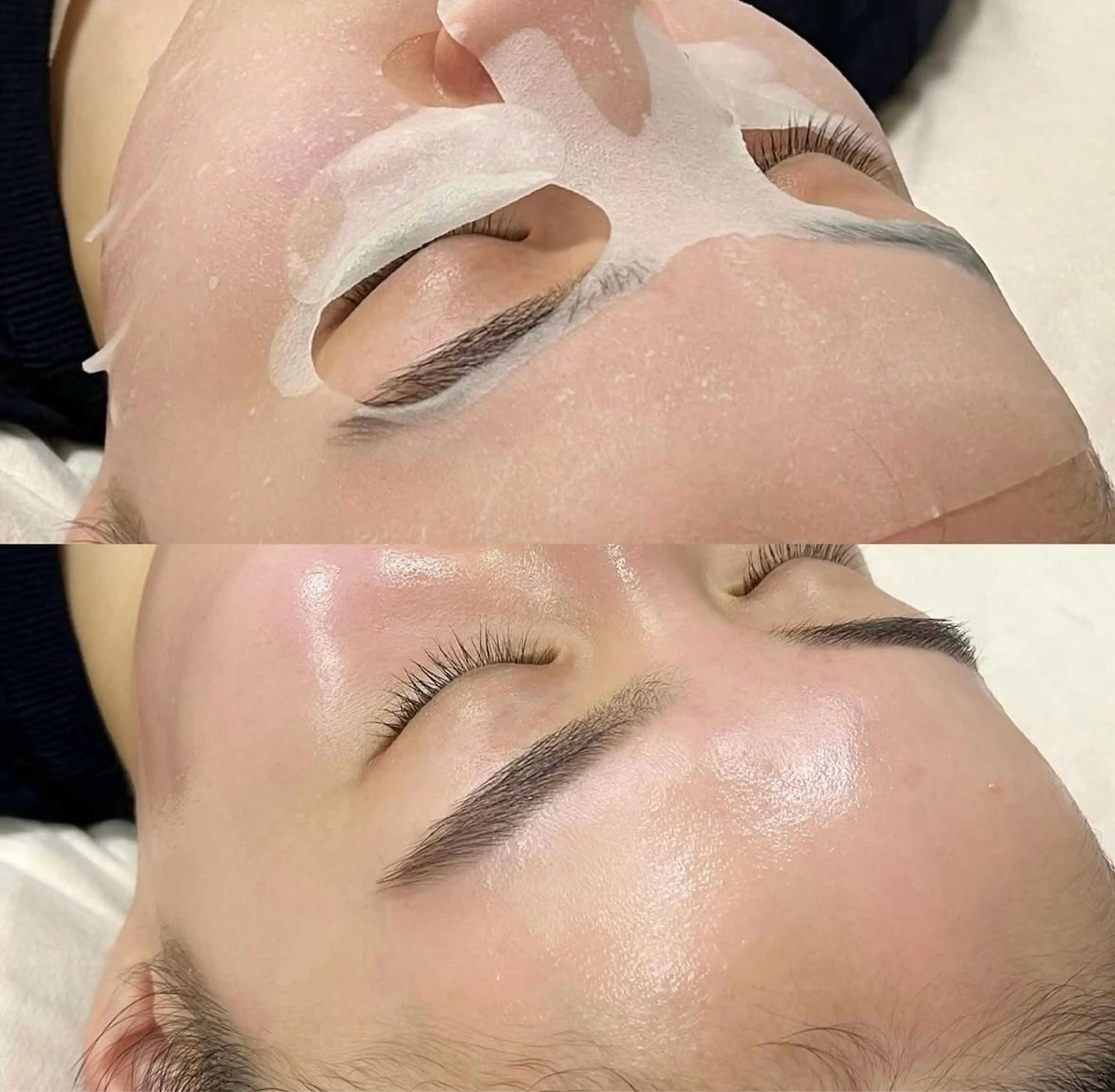 フェイシャルワックス脱毛（ヘッドスパ、肩首マッサージ、フェイシャルマッサージ付き）の写真