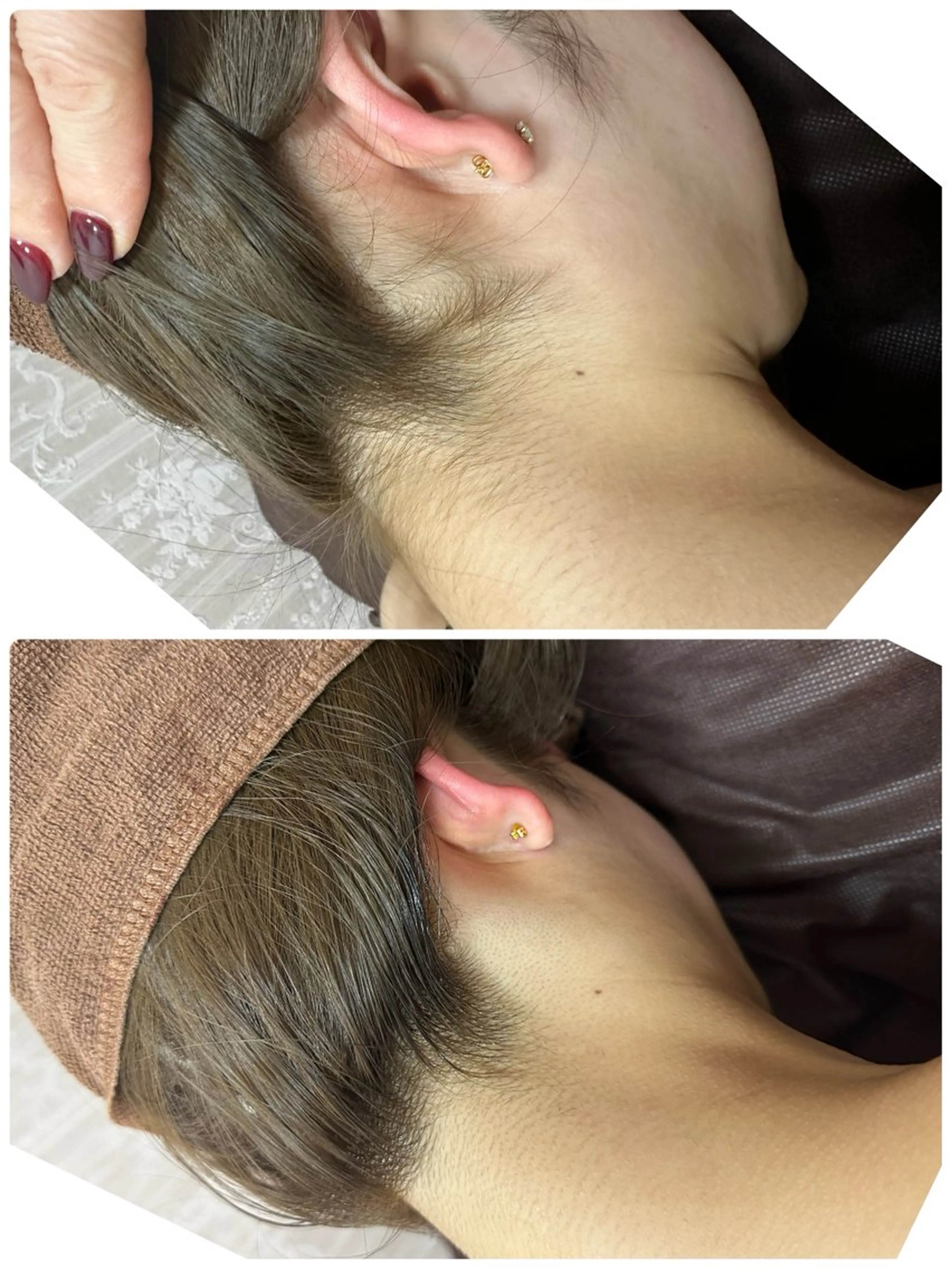 脱毛 桐山 まどかのエステ・リラクイメージ