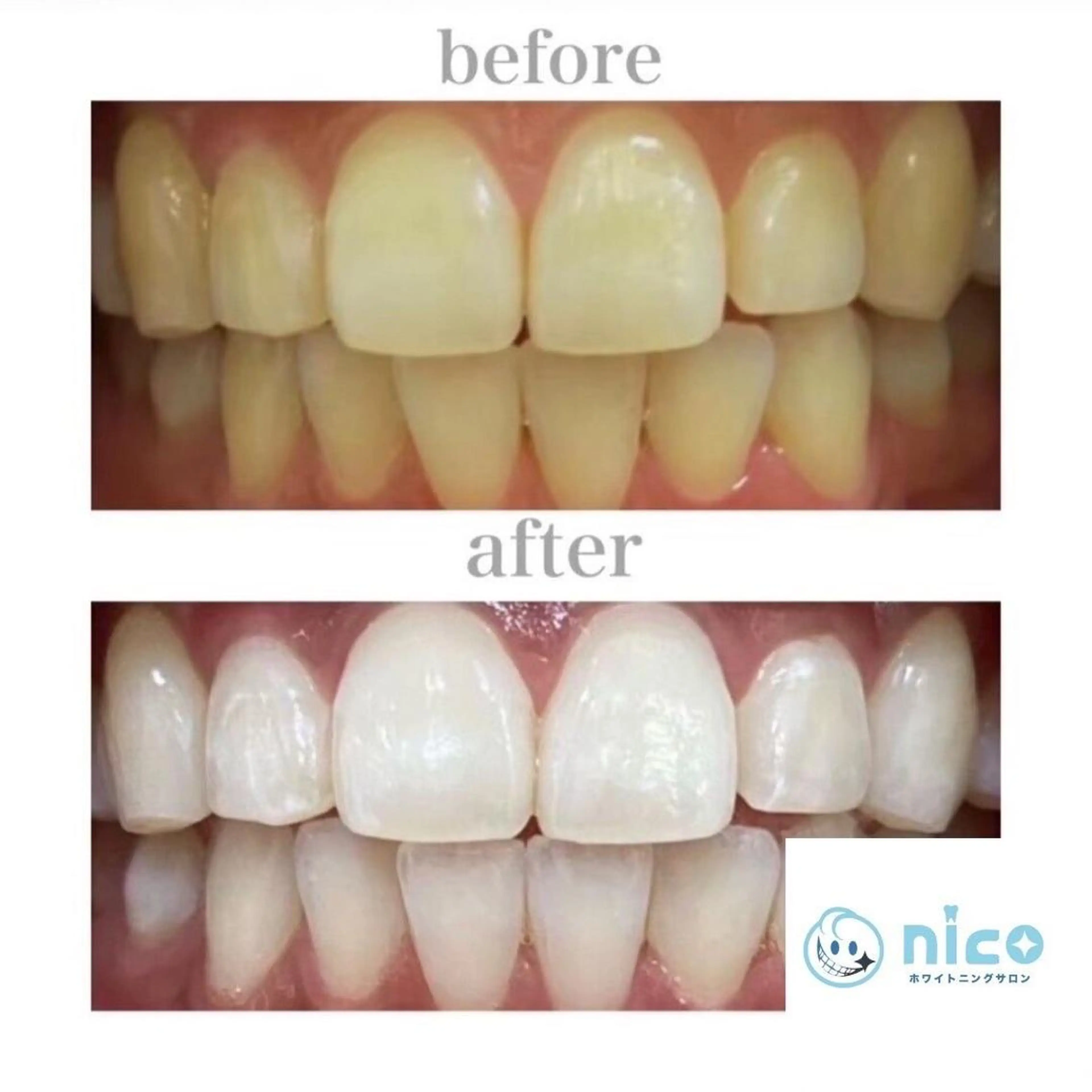 アイブロウ その他 ホワイトニングサロン nico西葛西店のその他イメージ