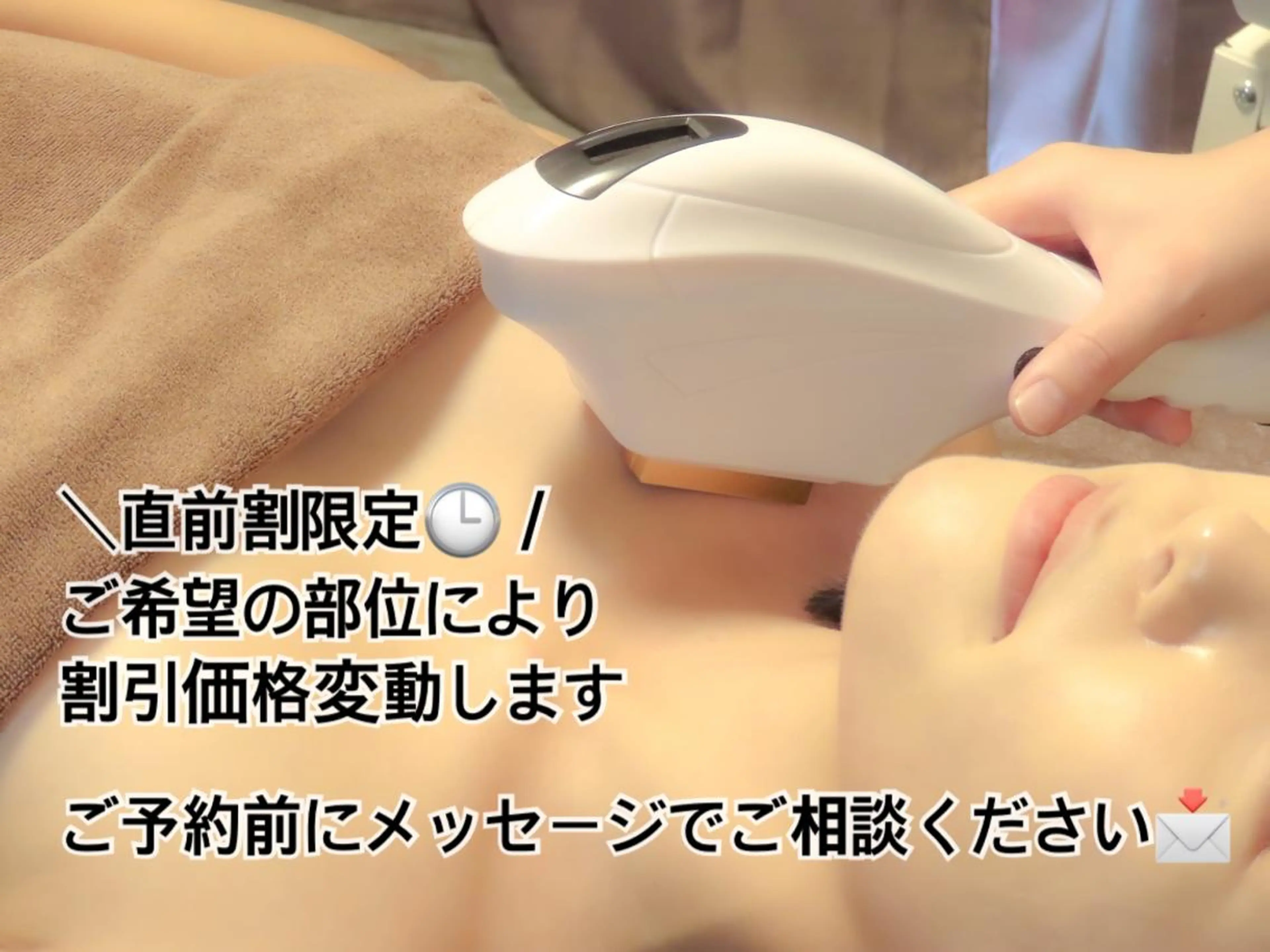 Felice🌸脱毛 ・光フェイシャルのその他イメージ