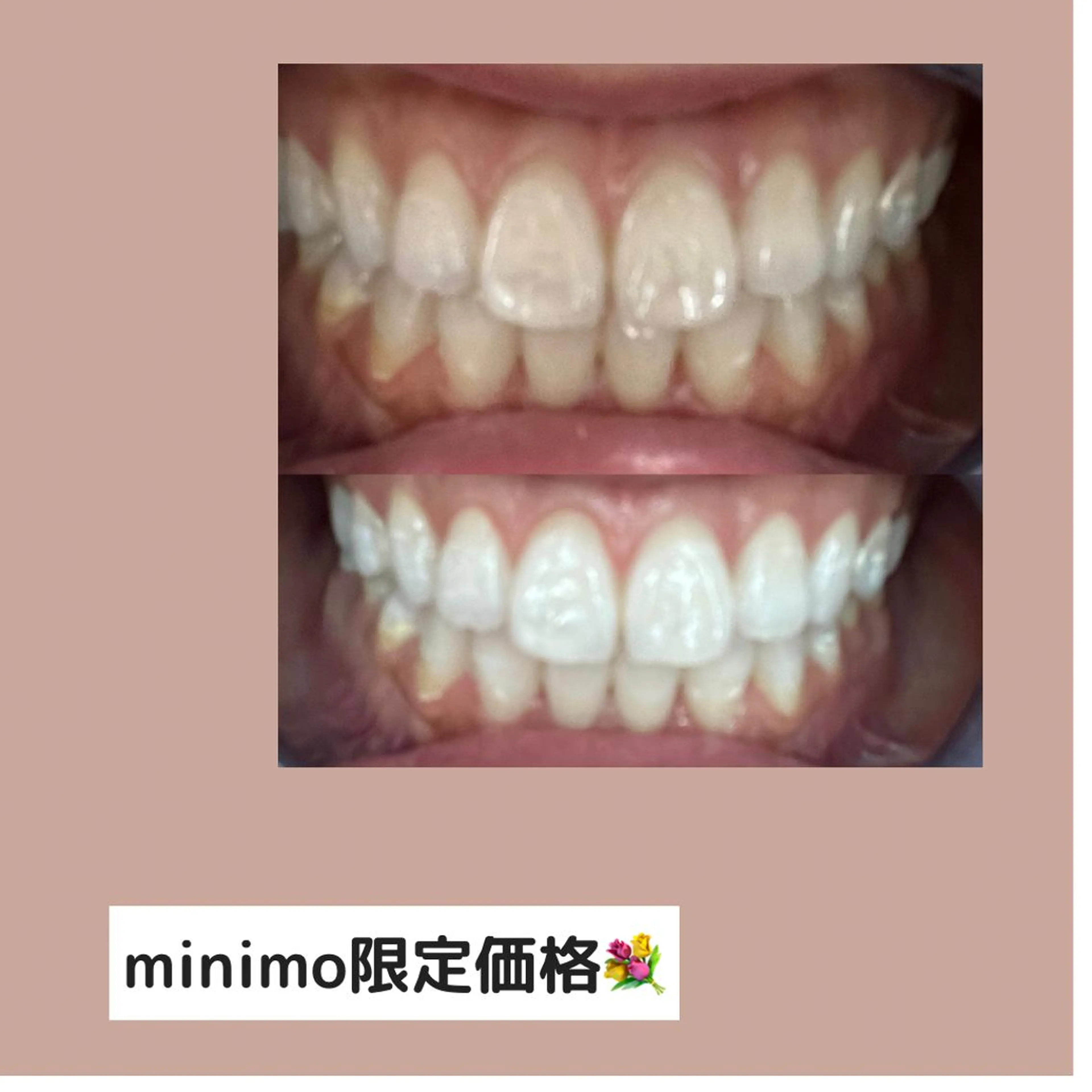 眉毛　まつげパーマ ルクス銀座店の眉毛・アイブロウイメージ