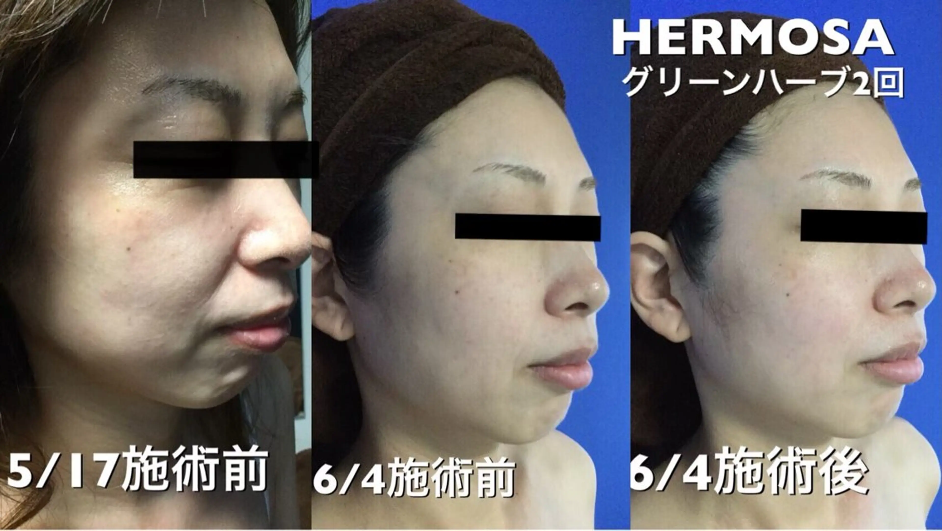 オールハンド フェイシャルのエステ・リラクイメージ