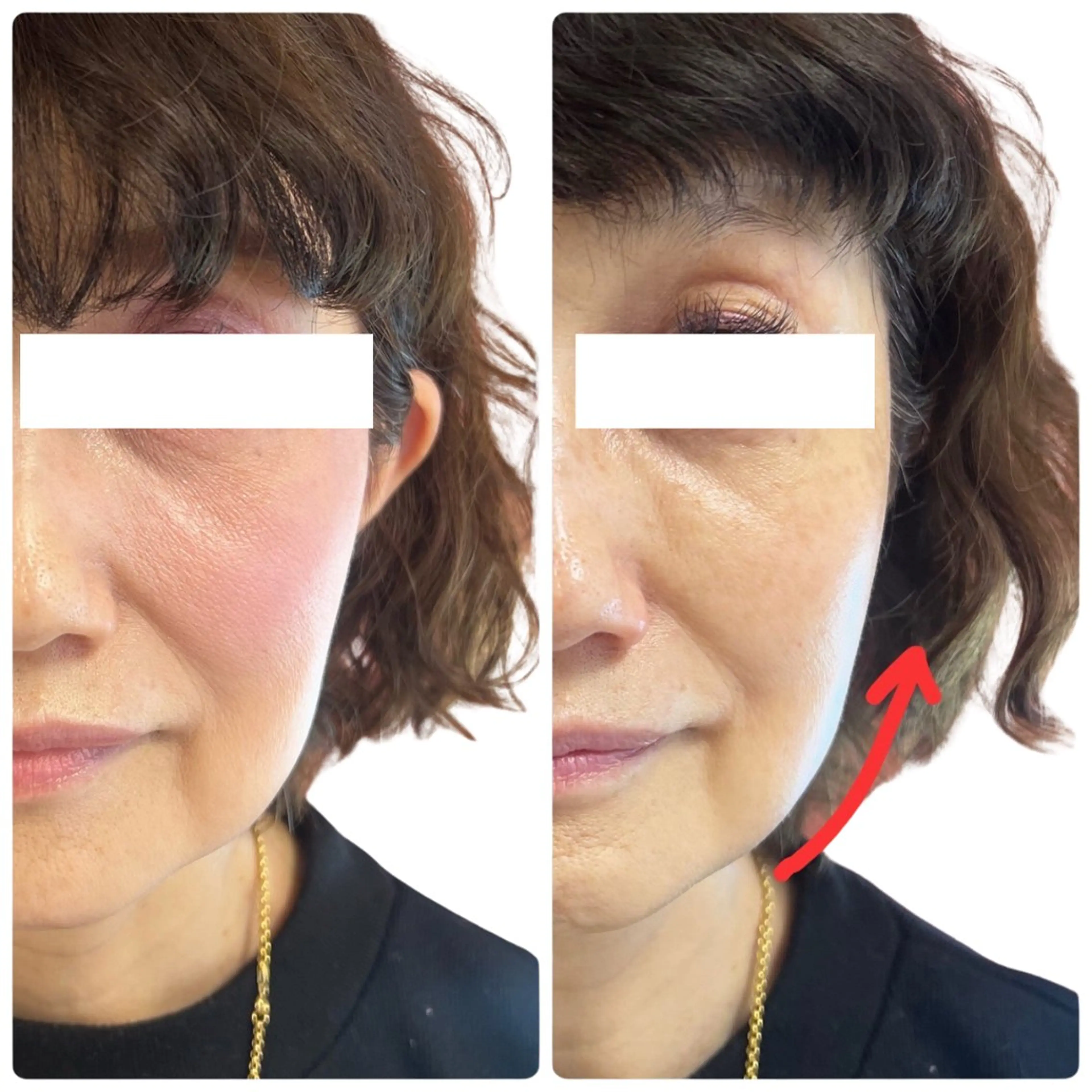 その他 Astorie 相模大野エステのその他イメージ