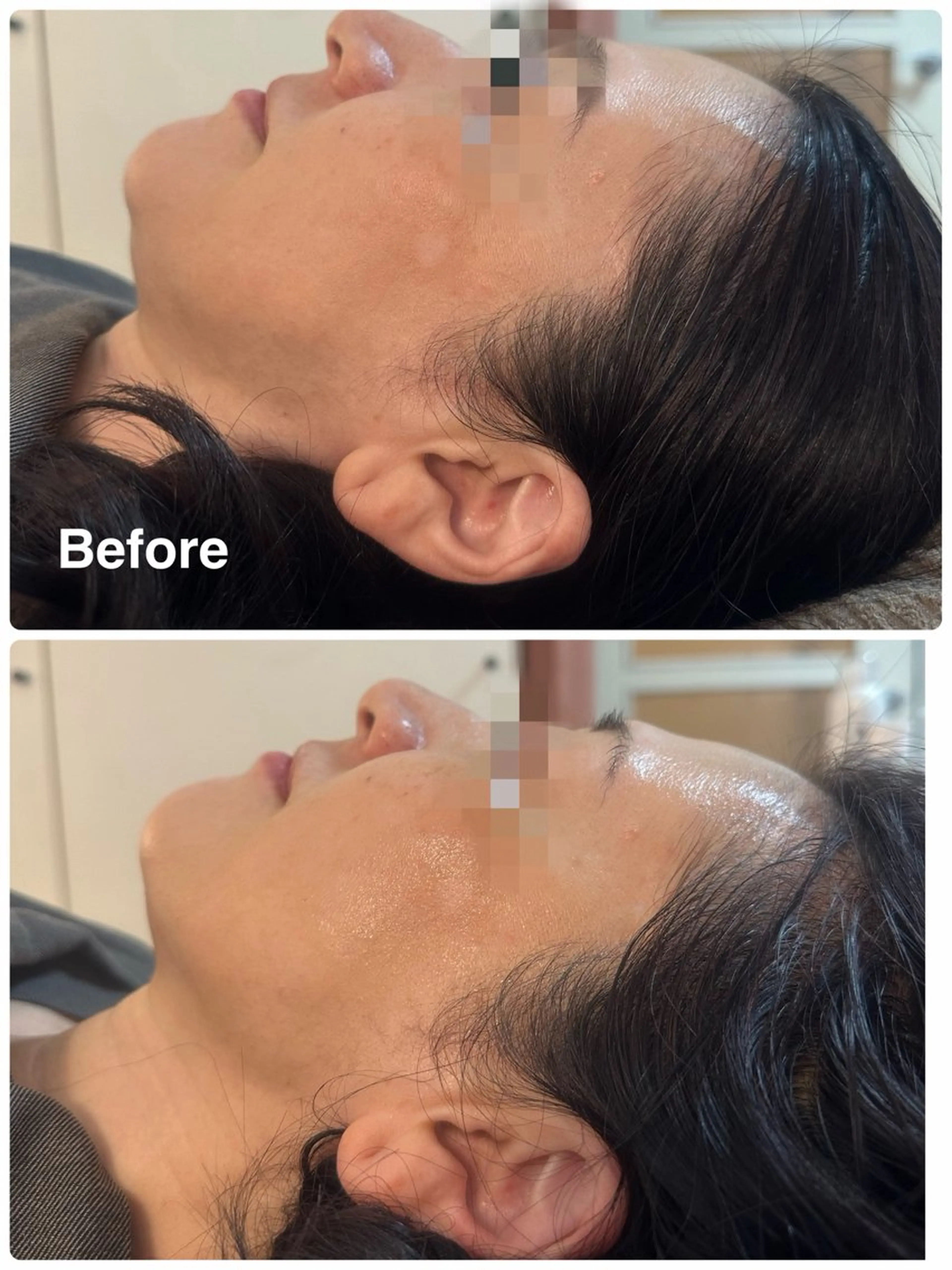 エステ NICORI所属・NICORI大宮 (看護師)塩野飛のエステ・リラクイメージ