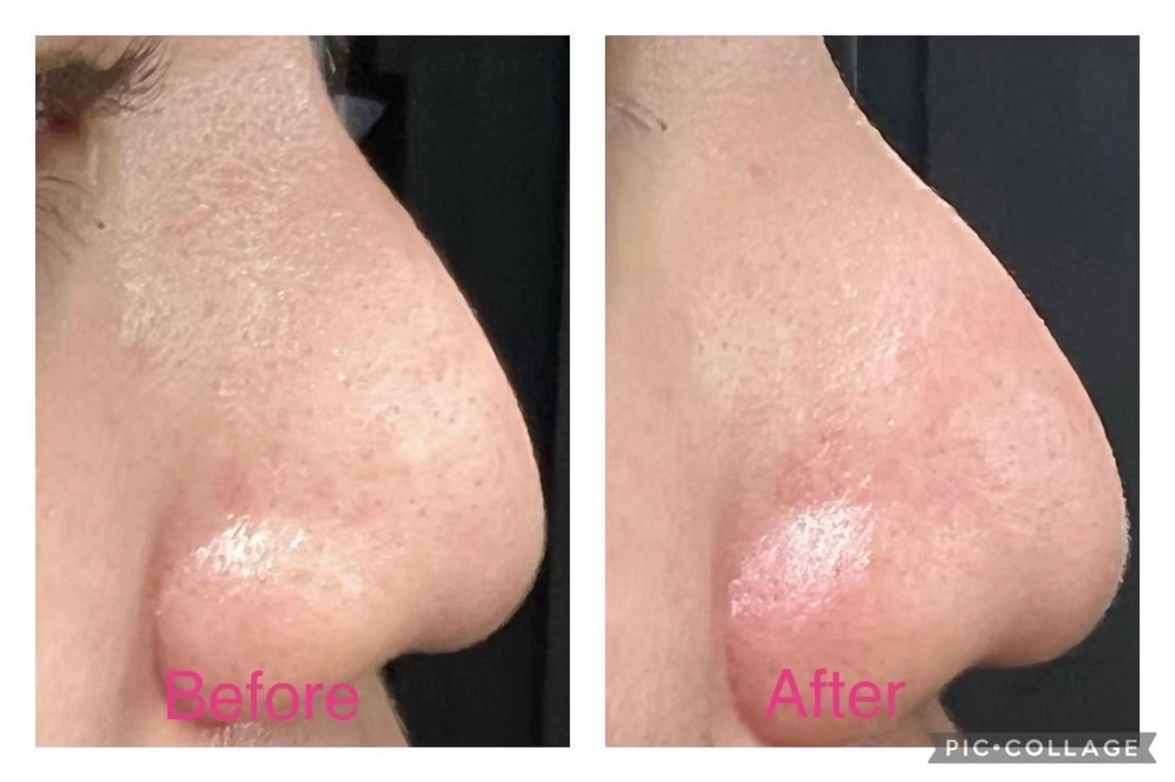 脱毛×アイラッシュCeriseLaLa所属・まつげ＆アイブロウ スリーズララ🍒のマツエク・マツパデザイン