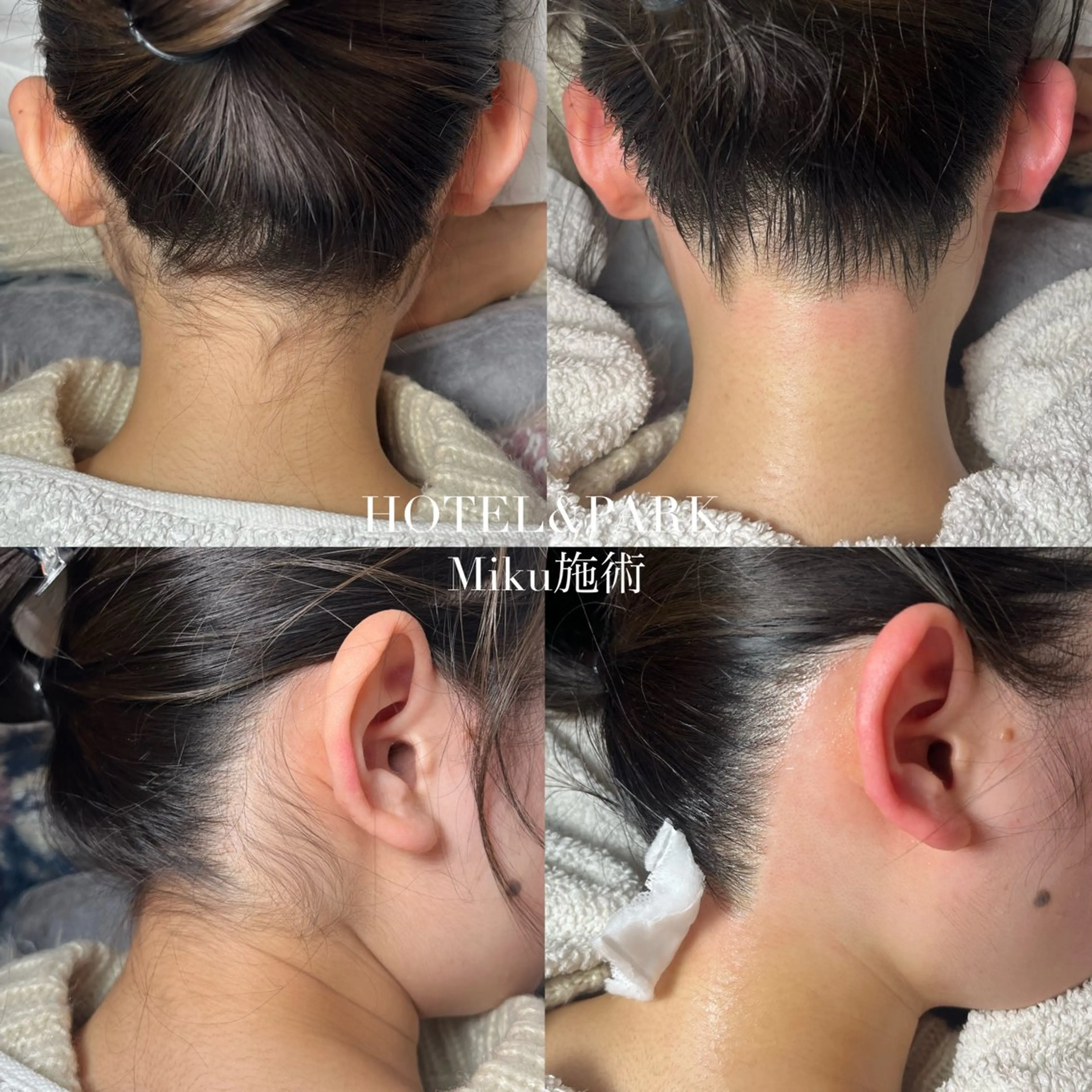 脱毛 HOTEL&PARK Mikuワックス脱毛のエステ・リラクイメージ