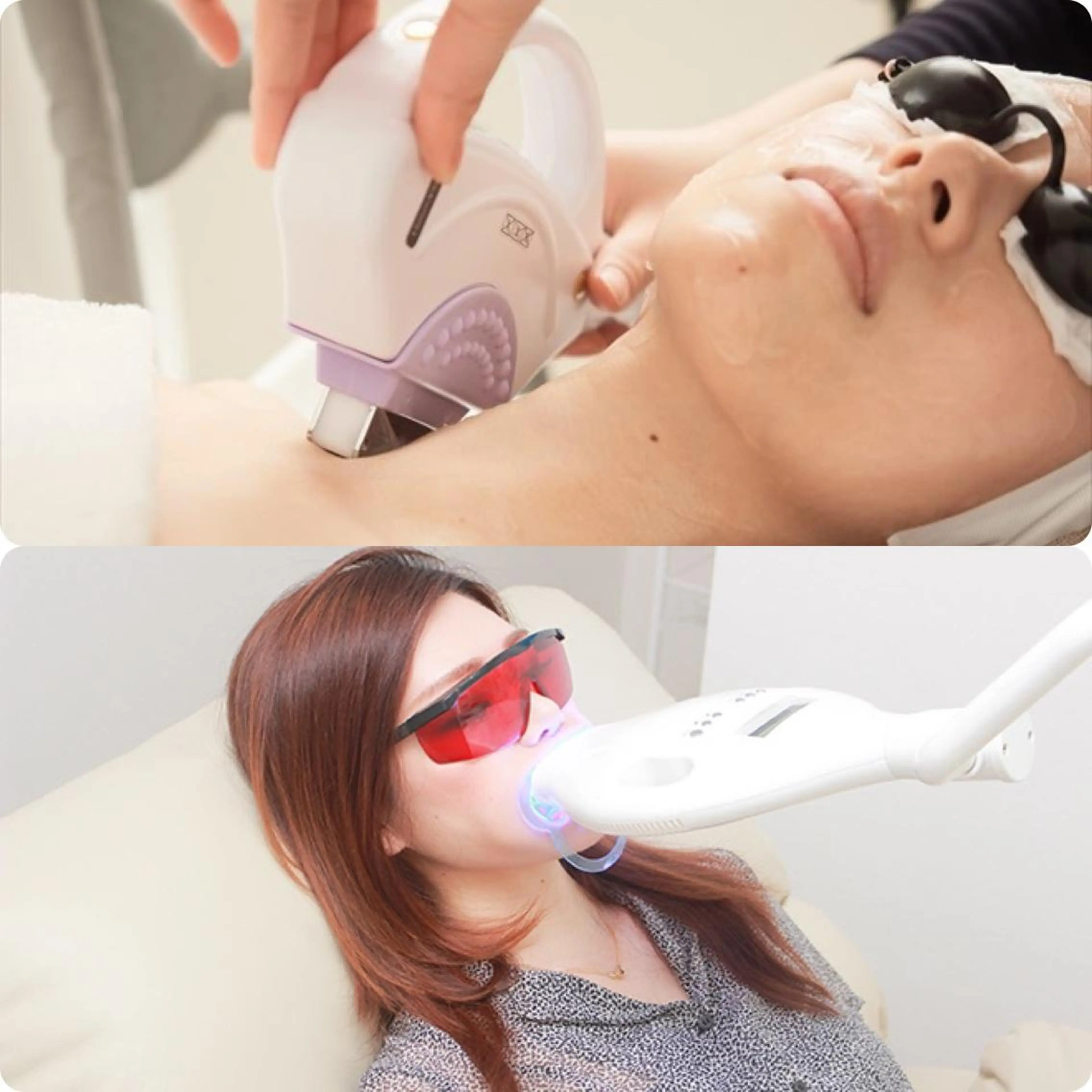 【お得なセット♪】 最新光フェイシャル（クレンジングパック付き）＋プレミアムホワイトニングの写真