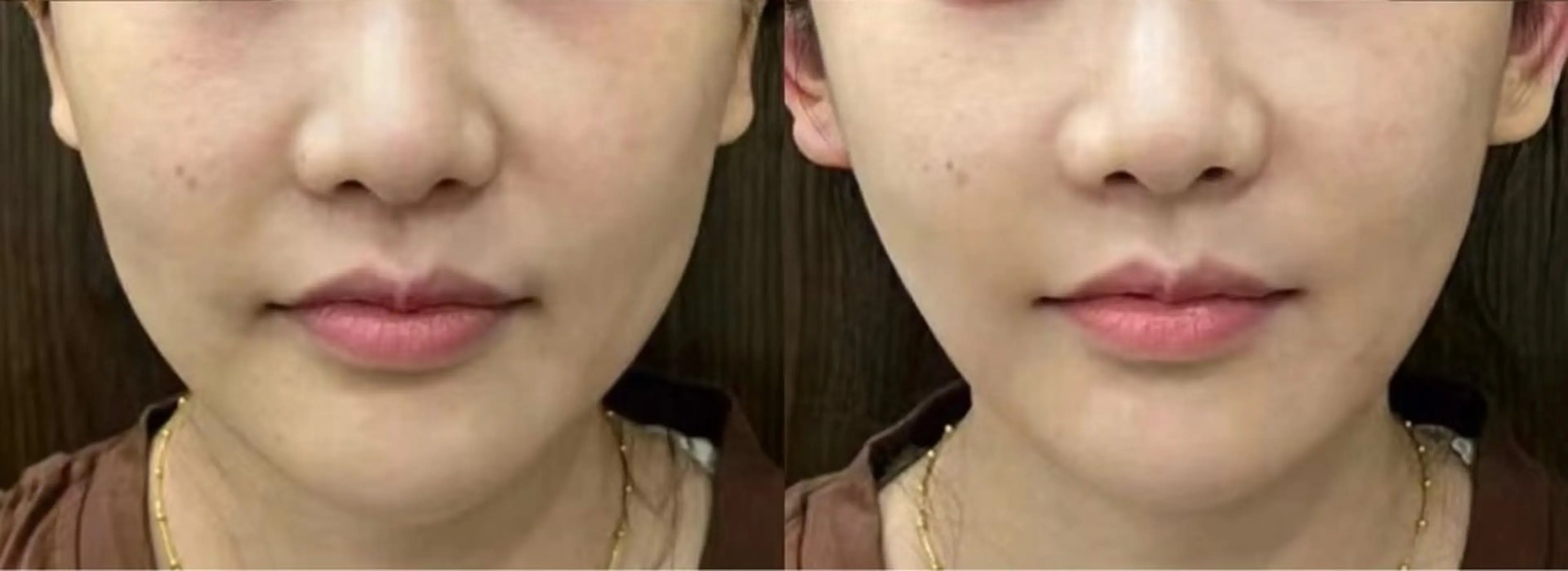 エステ リラク 愛維美水光美肌専門店所属・愛維美水光美肌専門店 メンズレディースokのエステ・リラクイメージ